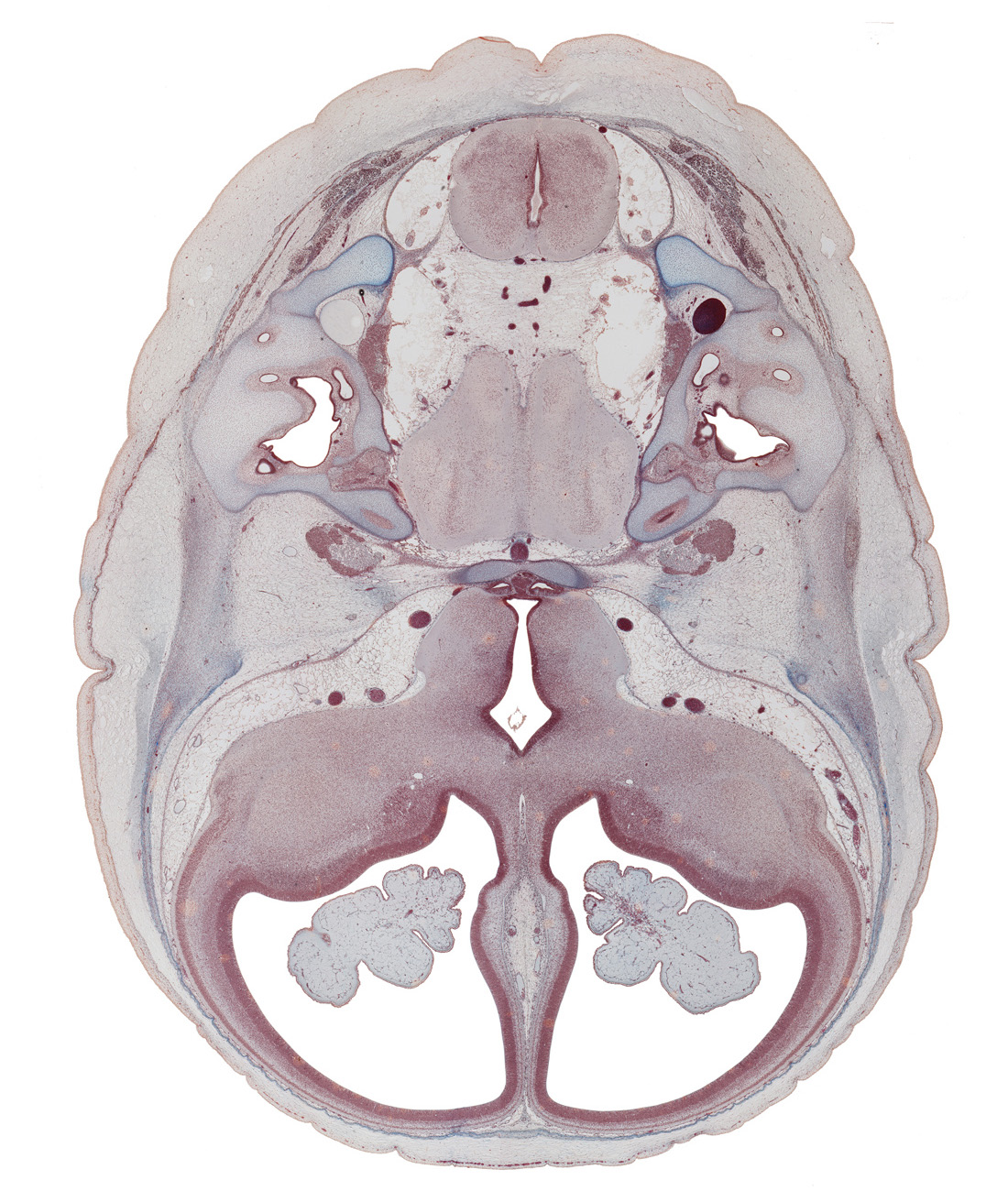 anterior inferior cerebellar artery, anterior semicircular duct, anterior spinal artery, basilar artery, cephalic edge of cochlear duct, choroid plexus, dorsum sellae, edge of lesser wing of sphenoid, hippocampus, junction of endolymphatic duct and utricle, lateral semicircular duct, lateral ventricle, medulla oblongata, neurohypophysis, optic groove, optic tract, otic capsule, petrous part of temporal bone (otic capsule), pons region (metencephalon), posterior inferior cerebellar artery, posterior semicircular duct, pyramidal tract region, root of hypoglossal nerve (CN XII), sensory decussation, tuberal part of adenohypophysis