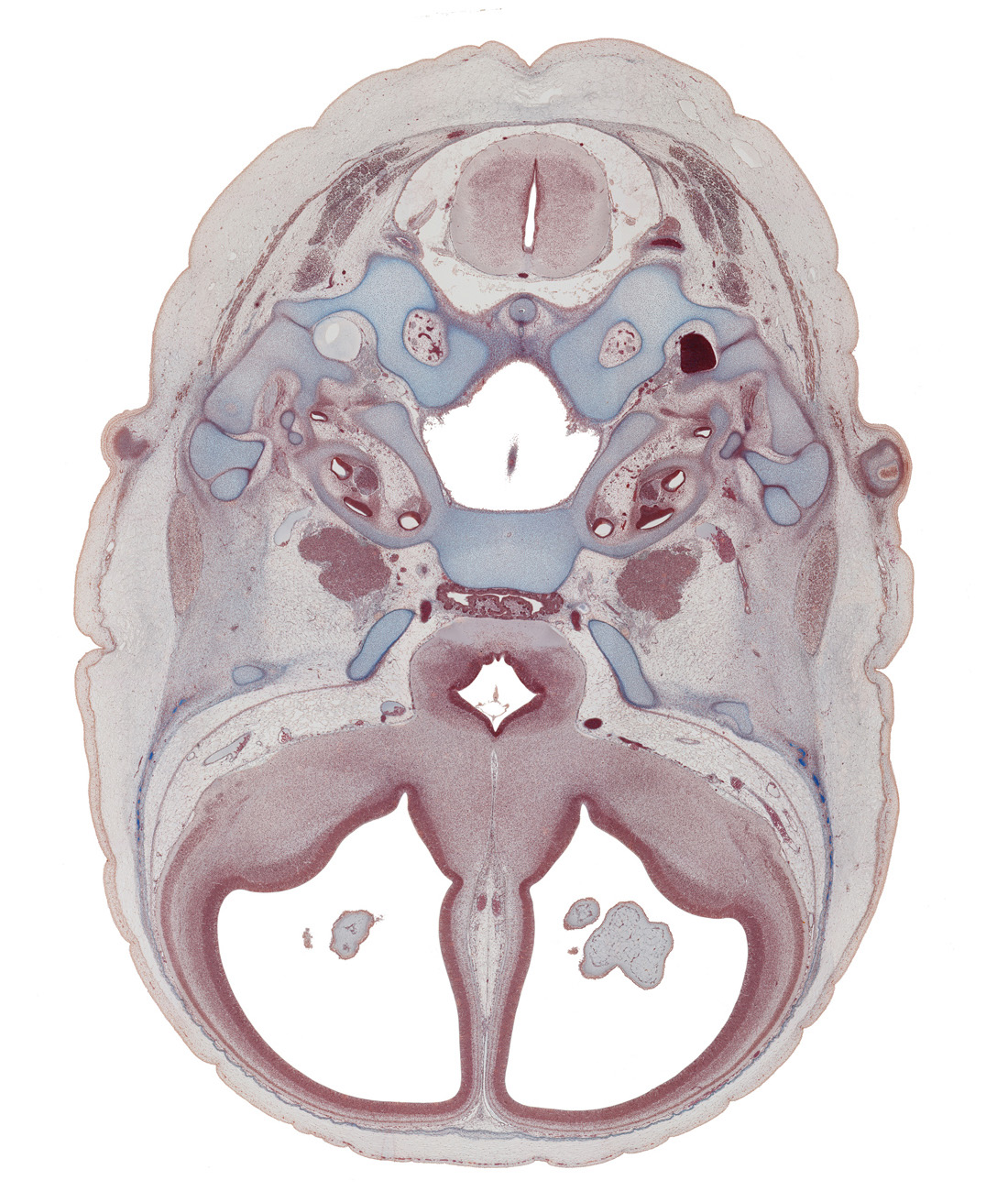 C-1 spinal ganglion, basisphenoid, central canal, cephalic part of spinal cord, cephalic tip of dens of C-2 vertebra (axis), distal part of adenohypophysis, dorsal funiculus, edge of basilar artery, edge of choroid plexus, exoccipital, hippocampus, hypoglossal canal, incus, internal carotid artery, lateral funiculus, lesser wing of sphenoid, malleus, neck of stapes, nucleus accumbens, ophthalmic nerve (CN V₁), optic chiasma (chiasmatic plate), otic capsule, piriform cortex (paleopallium), root of hypoglossal nerve (CN XII), spiral ganglion (CN VIII), stapedius muscle, trigeminal ganglion (CN V), ventral funiculus, vertebral artery