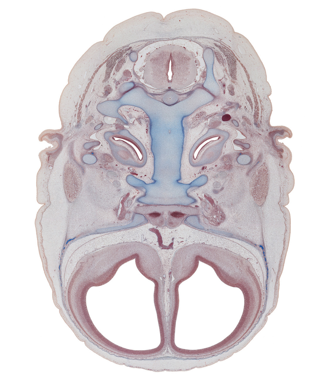 anterior communicating artery, atlanto-occipital joint, auricle, basi-occipital (basal plate), carotid canal, caudal part of cochlear duct, central canal, chorda tympani nerve, dens of C-2 vertebra (axis), greater wing of sphenoid, incus, internal carotid artery, malleus, mandibular nerve (CN V₃), maxillary nerve (CN V₂), neural arch of C-1 vertebra (atlas), notochord remnant, occipital condyle, ophthalmic nerve (CN V₁), optic canal, optic nerve (CN II), otic capsule, pre-optic area, spinal accessory nerve (CN XI), spinal cord, superior orbital fissure