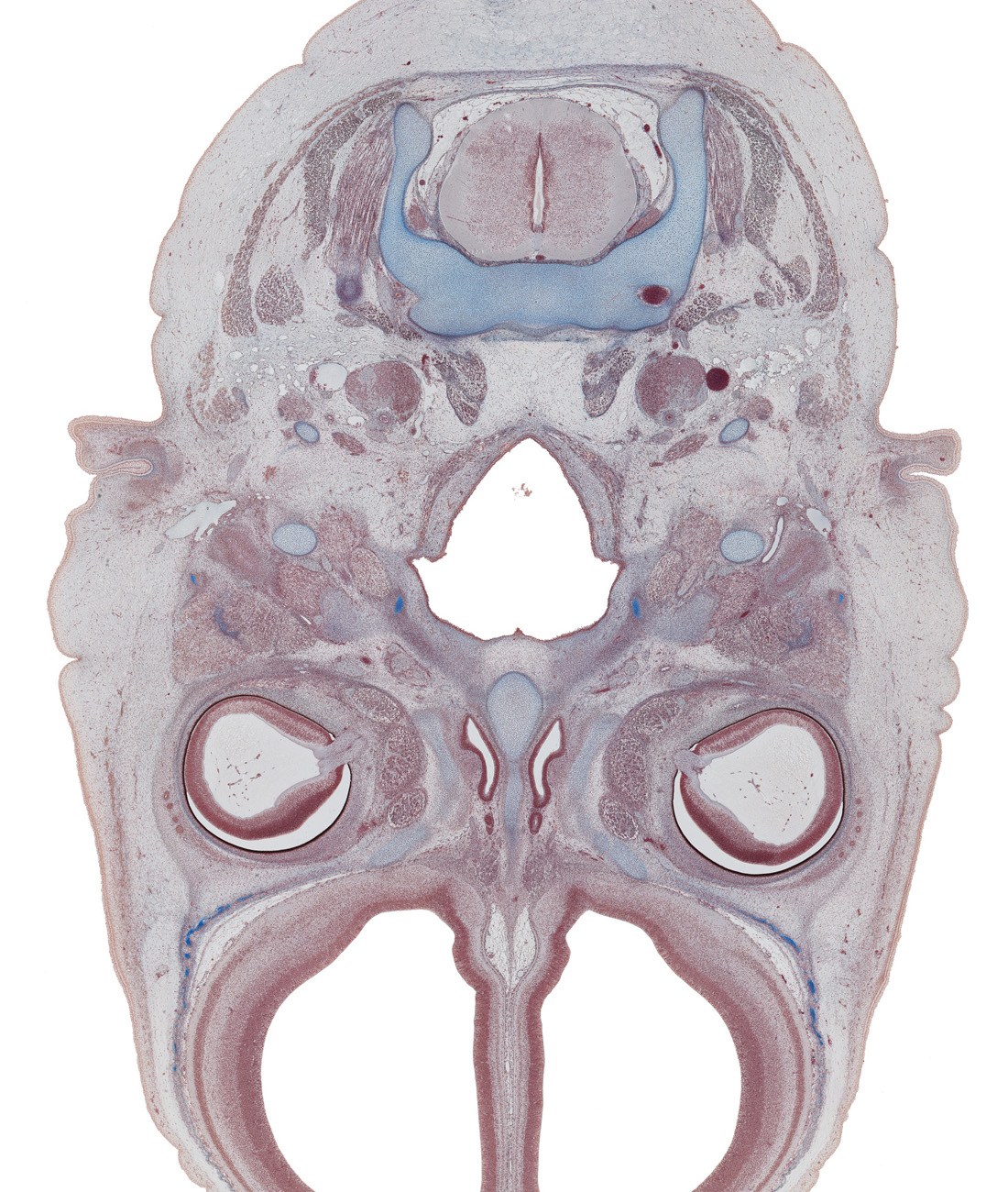C-2 / C-3 interganglion region, blood vessels in vitreous body, centrum of C-2 vertebra (axis), ethmoid, extrinsic ocular muscle(s), falx cerebri region, glossopharyngeal nerve (CN IX), inferior ganglion of vagus nerve (CN X), intraretinal space (optic vesicle cavity), longus capitis muscle, nasal cavity (nasal sac), nasopharynx, neural arch of C-2 vertebra (axis), optic nerve (CN II), spinal accessory nerve (CN XI), splenius muscle, stylopharyngeus muscle, superior cervical sympathetic ganglion, trapezius muscle, vertebral artery