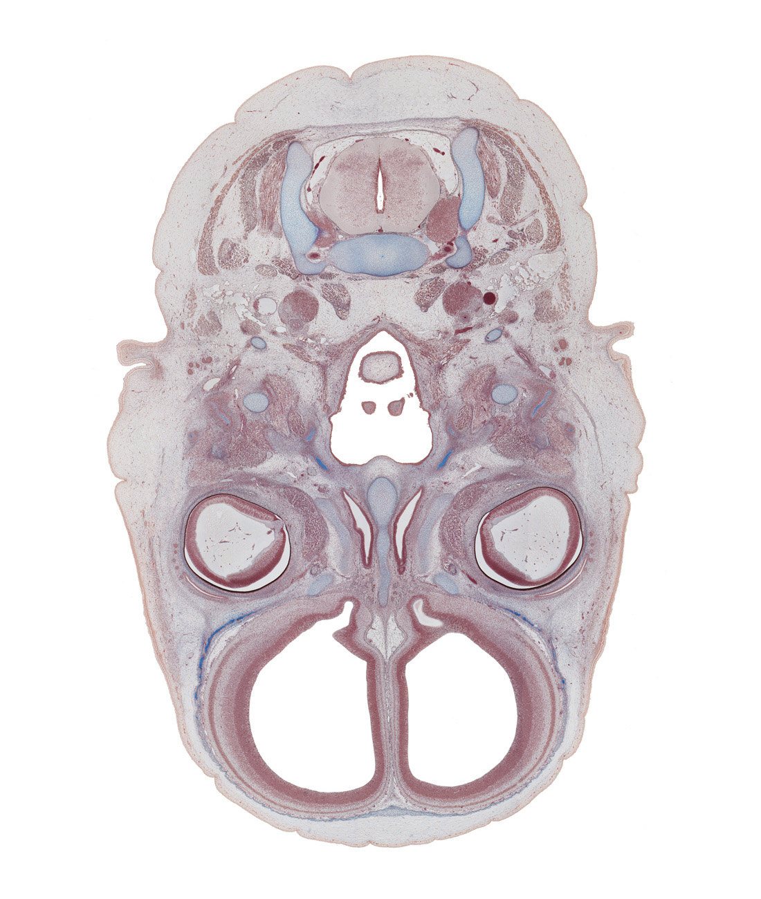 C-3 spinal ganglion, caudal part of auricle, crista galli, edge of epiglottis, edge of unfused palatine shelf, ethmoid, falx cerebri region, frontal bone ossification, internal carotid artery, laryngeal pharynx, lateral ventricle, nasal cavity (nasal sac), nasopharynx, notochord, olfactory bulb, olfactory ventricle, oropharynx, styloid process, superior pharyngeal constrictor muscle, superior sagittal sinus