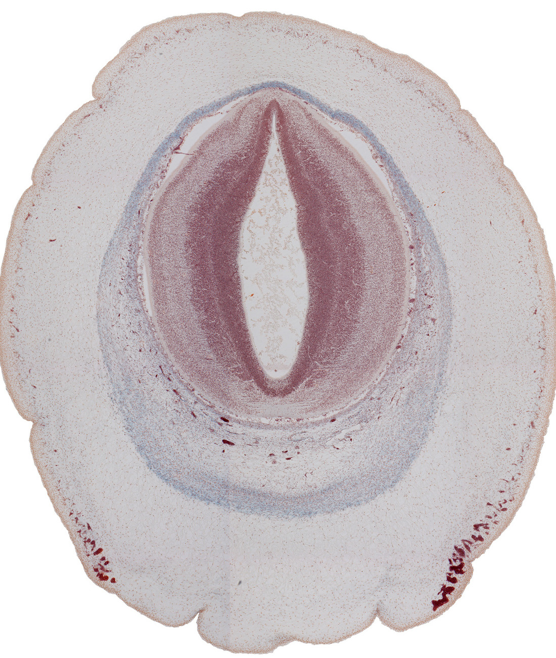 cerebral aqueduct (mesocoele), loose connective tissue, mesencephalon (tectum), osteogenic layer, subarachnoid space, subcutaneous vascular plexus, surface ectoderm, venous plexus(es)