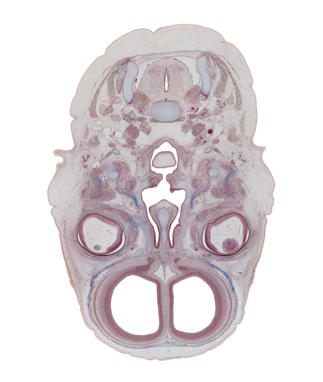 C-3 spinal ganglion, choana, cortical plate, falx cerebri region, frontal bone ossification, frontal lobe region of cerebral hemisphere, inferior ganglion of vagus nerve (CN X), intraretinal space (optic vesicle cavity), laryngeal pharynx, longissimus capitis muscle, medial pterygoid muscle, nasal cavity (nasal sac), nasal septal cartilage, nasopharynx, neural layer of retina, oropharynx, pigmented layer of retina, retropharyngeal space, semispinalis capitis muscle, splenius muscle, superior pharyngeal constrictor muscle, superior sagittal sinus, trapezius muscle, unfused palatine shelf