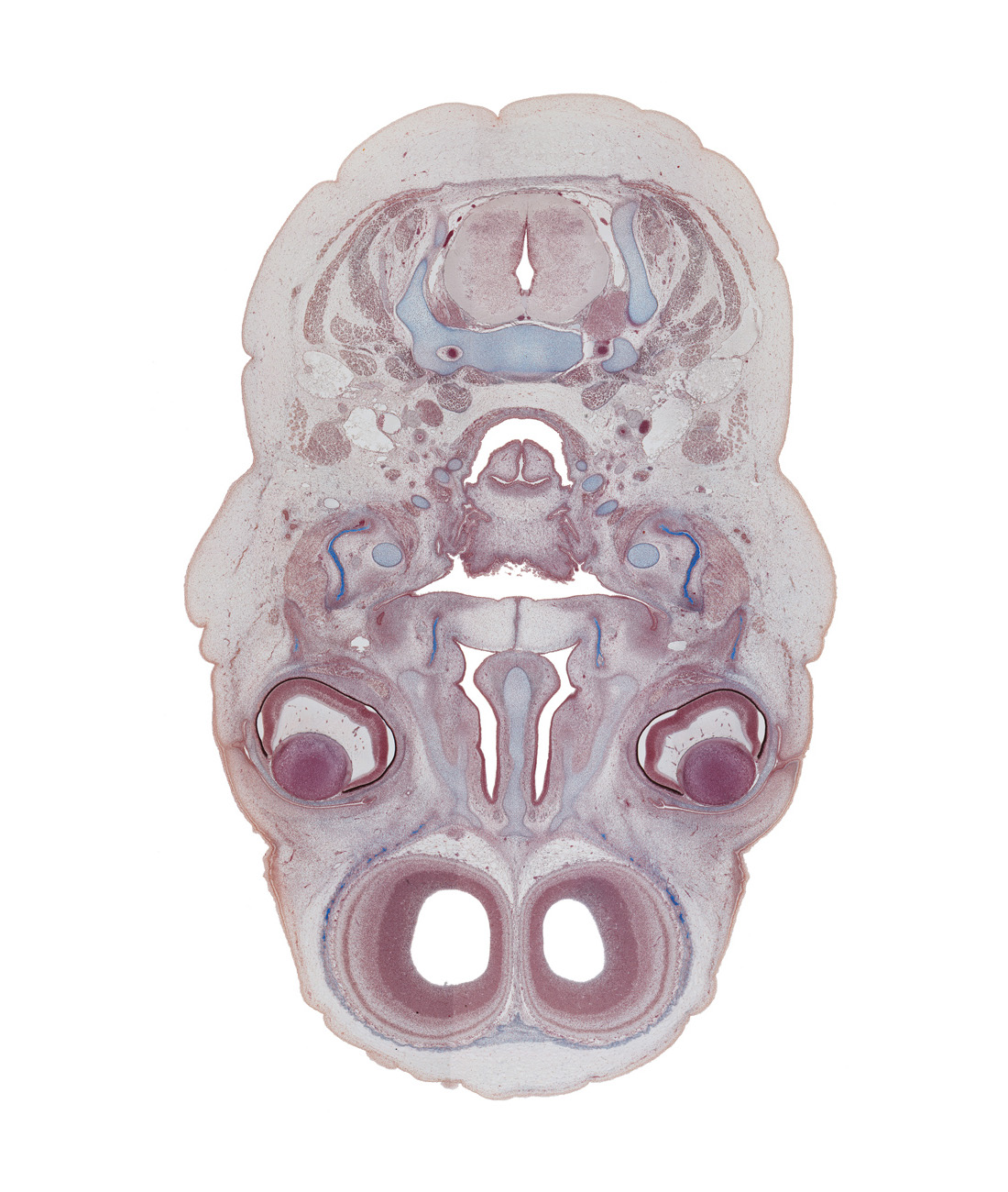 C-4 spinal ganglion, anterior horn of lateral ventricle, frontal bone ossification, jugular lymph sac, junction of eyelids, laryngeal pharynx, lens, lower eyelid, masseter muscle, nasal capsule cartilage, nasal cavity (nasal sac), oropharynx, palatine ossification, retropharyngeal space, tongue root, upper eyelid