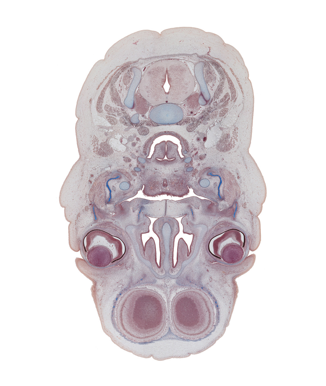 C-4 spinal ganglion, centrum of C-3 vertebra, cortical plate, digastric tendon, falx cerebri region, inferior nasal concha, intraretinal space (optic vesicle cavity), laryngeal pharynx, longus cervicis muscle, middle nasal concha, middle nasal meatus, neural layer of retina, pigmented layer of retina, superior cervical sympathetic ganglion, thyroglossal duct remnant, trapezius muscle, upper eyelid