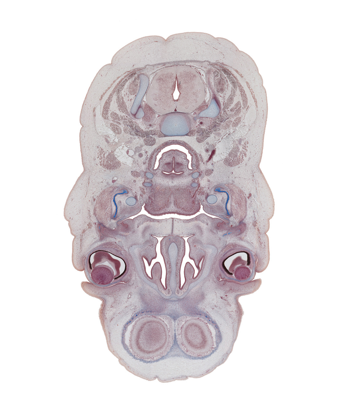 C-4 / C-5 interganglion region, central canal, dorsal horn of grey matter, edge of cerebral hemisphere (neopallium), edge of lens, frontal bone ossification, frontal lobe region of cerebral hemisphere, inferior nasal meatus, masseter muscle, nasal septal cartilage, parotid duct, pharyngeal arch 1 cartilage (Meckel), ramus of mandible, semispinalis capitis muscle, semispinalis cervicis muscle, splenius muscle, sternocleidomastoid muscle, trapezius muscle, ventral horn of grey matter