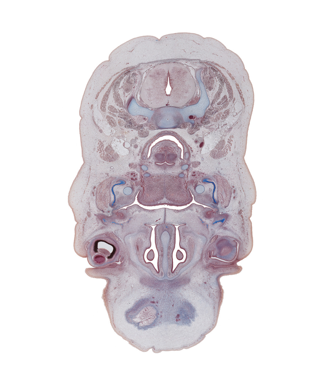 C-5 spinal ganglion, arytenoid swelling, conjunctival sac, dorsal funiculus, edge of frontal bone ossification, edge of middle nasal concha, edge of subarachnoid space, internal jugular vein, junction of eyelids, laryngeal pharynx, lateral funiculus, lower eyelid, nasal capsule cartilage, oral cavity, orbicularis oculi muscle, submandibular ganglion, superior cervical sympathetic ganglion, tooth bud(s), upper eyelid, vagus nerve (CN X), ventral funiculus