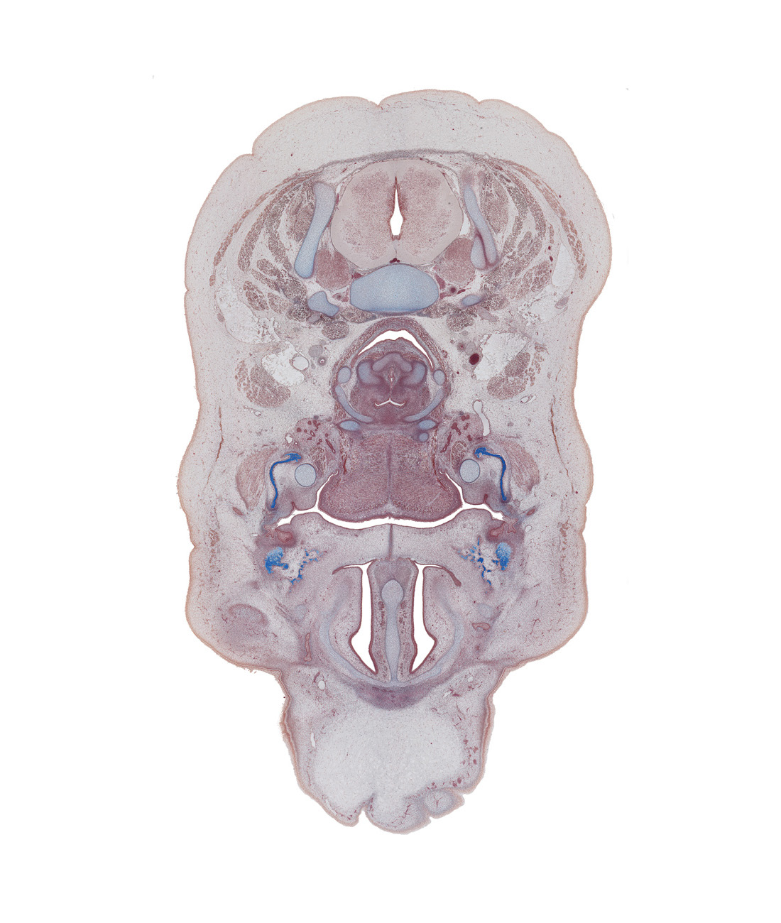 C-5 spinal ganglion, arytenoid cartilage, buccinator muscle, horizontal layer of intrinsic muscles of tongue, inferior pharyngeal constrictor muscle, interorbital ligament, junction of cartilages of pharyngeal arches 2 and 3, laryngeal pharynx, nasal capsule, nasal cavity (nasal sac), oral cavity, parotid duct, pharyngeal arch 1 cartilage (Meckel), platysma muscle, subcutaneous tissue of forehead, submandibular ganglion, surface ectoderm, thyroid cartilage, trapezius muscle