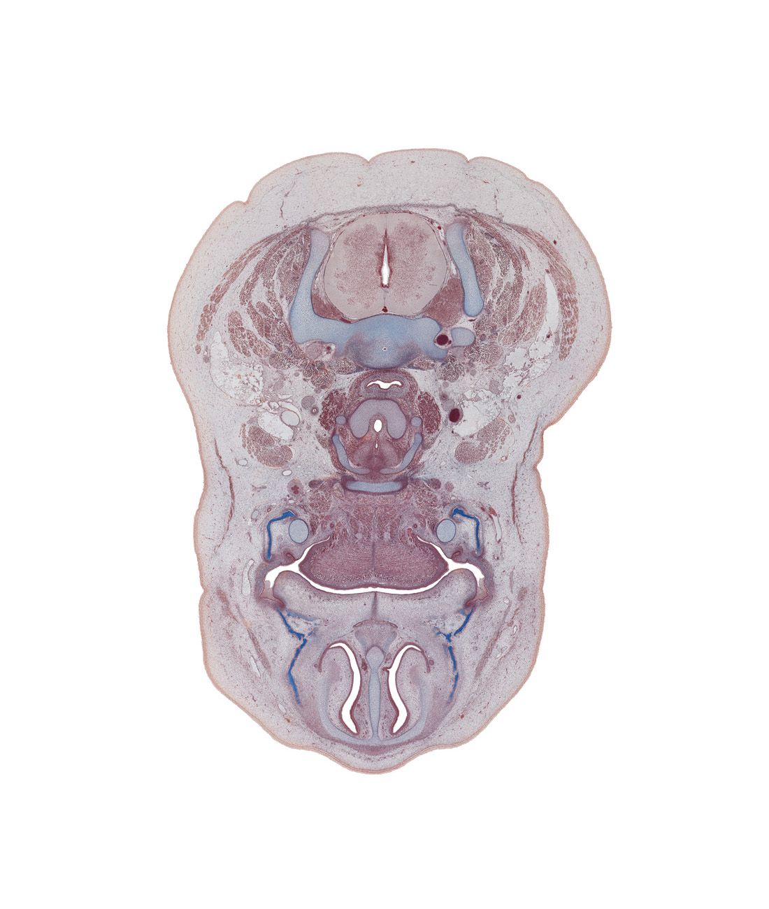 C-6 spinal ganglion, body of hyoid (pharyngeal arch 3 cartilage), body of tongue, common carotid artery, cricoid cartilage, cricothyroid muscle, facial muscle layer, internal jugular vein, neural arch of C-5 vertebra, platysma muscle, secondary palate, septal cartilage, sternocleidomastoid muscle, sympathetic trunk, thyroid cartilage, thyroid gland, vagus nerve (CN X)