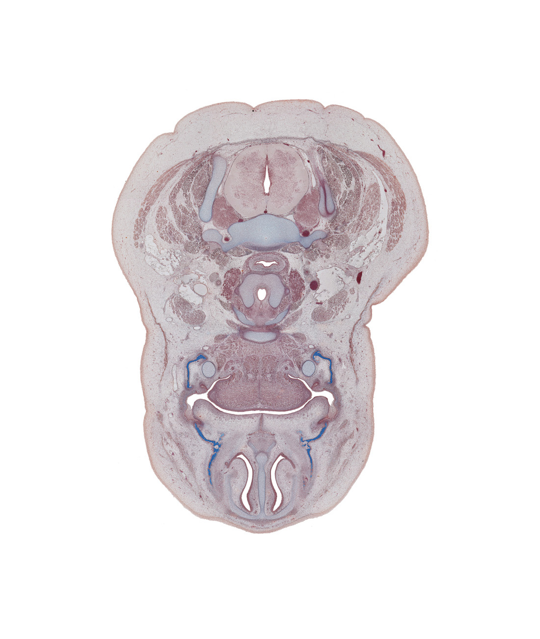 C-6 spinal ganglion, body of hyoid (pharyngeal arch 3 cartilage), body of mandible ossification, central canal, common carotid artery, cricoid cartilage, digastric tendon, dural limiting membrane, inferior nasal concha, infraglottic cavity, laryngeal pharynx, longus cervicis muscle, maxilla ossification, nasal cavity (nasal sac), nasal septum, oral cavity, thyroid gland