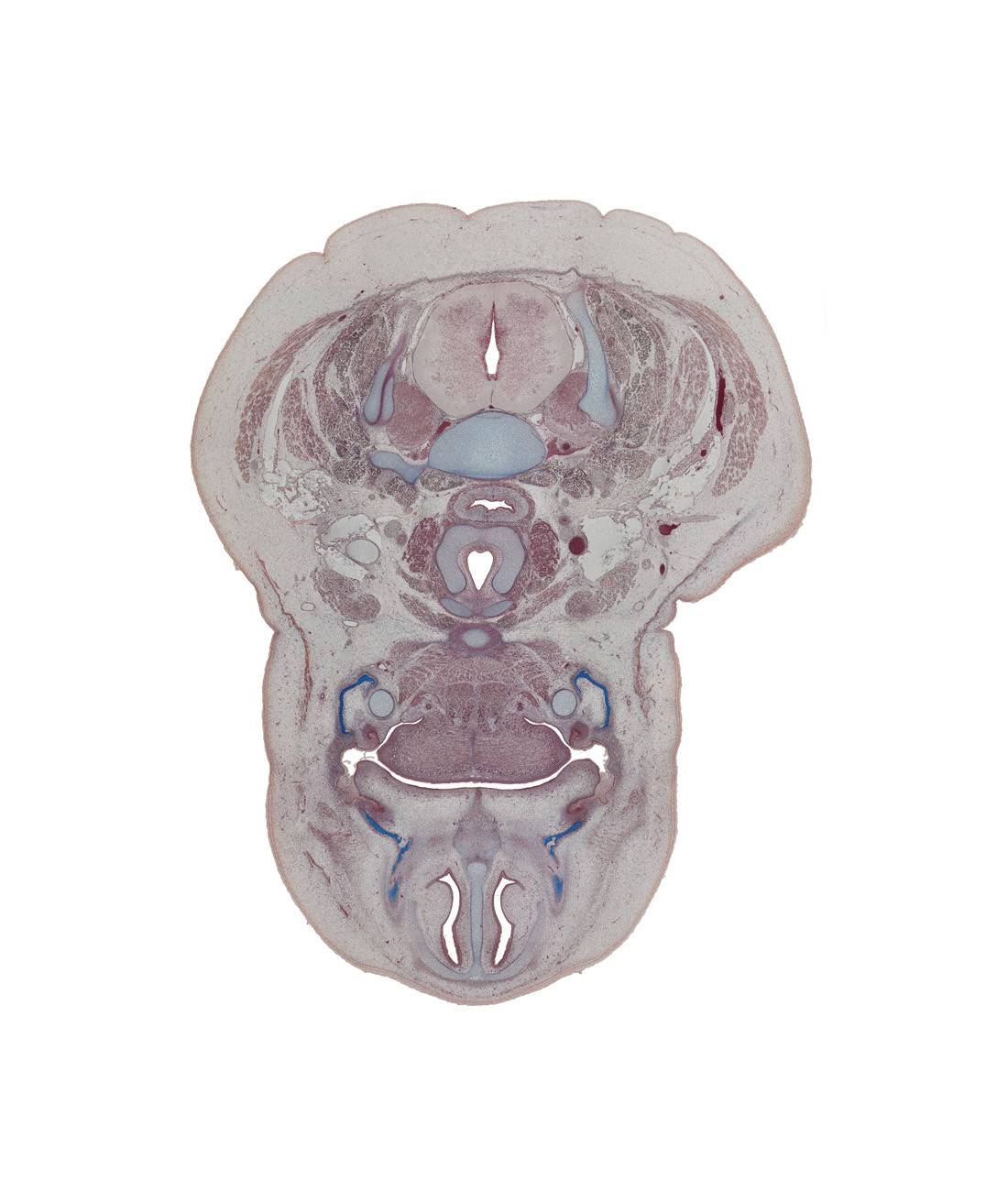 body of hyoid (pharyngeal arch 3 cartilage), cricoid cartilage, dorsal funiculus, dorsal horn of grey matter, dorsal median septum, geniohyoid muscle, infraglottic cavity, internal jugular vein, laryngeal pharynx, lateral funiculus, longus cervicis muscle, maxilla ossification, nasal septum, oral cavity, septal cartilage, sternocleidomastoid muscle, tooth bud(s), ventral median septum