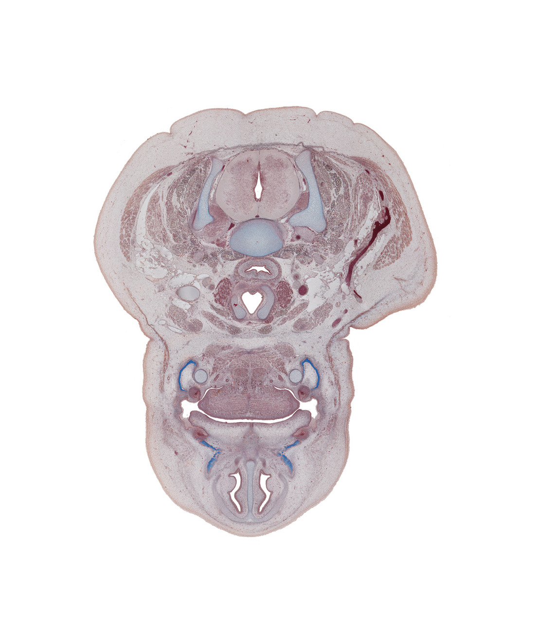 C-6 / C-7 interganglion region, cricoid cartilage, dorsal funiculus, dorsal horn of grey matter, dorsal median septum, external jugular vein, geniohyoid muscle, internal jugular vein, jugular lymph sac, lateral funiculus, nasal cavity (nasal sac), nasal septum, oral cavity, platysma muscle, septal cartilage, sternocleidomastoid muscle, tooth bud(s), ventral funiculus, ventral horn of grey matter, ventral median septum