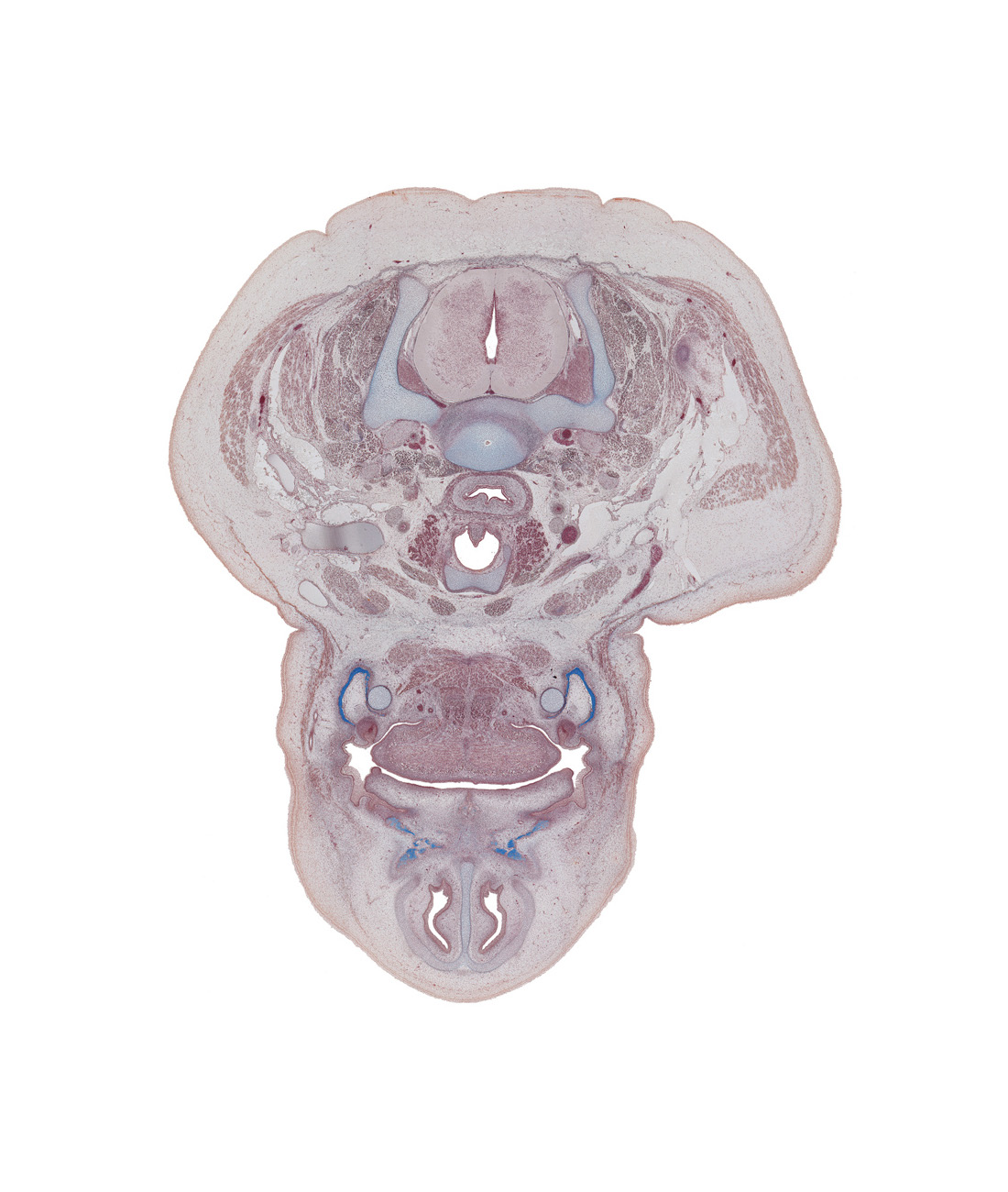 C-7 spinal ganglion, anterior belly of digastric muscle, body of mandible ossification, body of tongue, cricoid cartilage, edge of scapula, esophagus, geniohyoid muscle, infraglottic cavity, internal jugular vein, levator scapulae muscle, maxilla ossification, nasal capsule, nasal cavity (nasal sac), oral cavity, pharyngeal arch 1 cartilage (Meckel), region of incisive foramen, sublingual gland, thyroid gland, tooth bud(s), vertebral artery