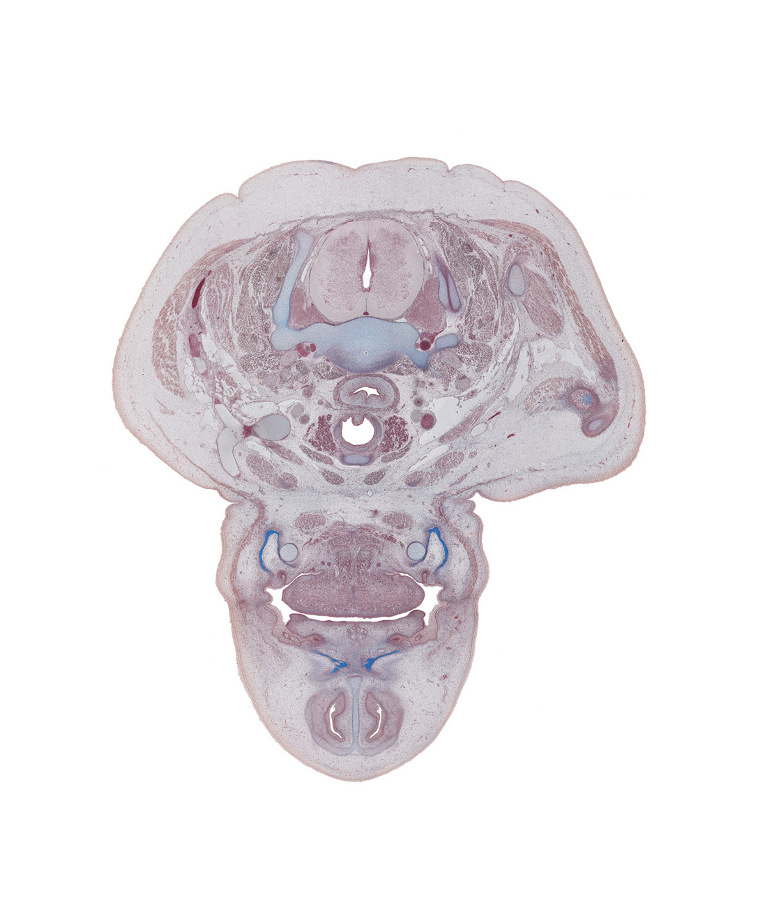 C-7 spinal ganglion, anterior belly of digastric muscle, body of mandible ossification, dorsum of tongue, edge of cricoid cartilage, levator scapulae muscle, muscular layer of esophagus, nasal cavity (nasal sac), nose, pharyngeal arch 1 cartilage (Meckel), retro-esophageal space, supraclavicular fossa region, thyroid gland, tooth bud(s), tracheal lumen