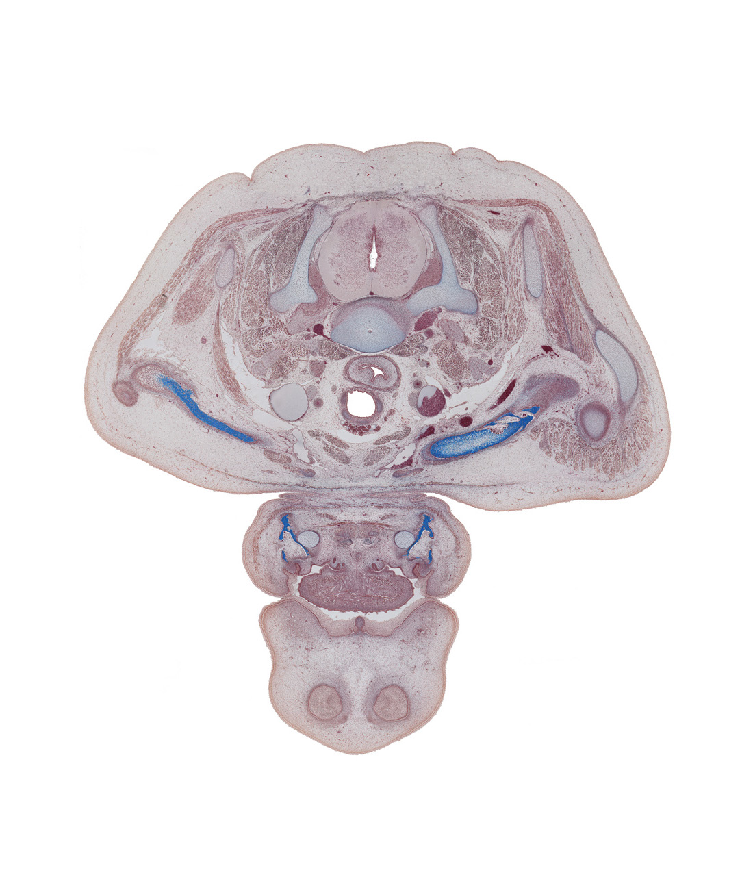 C-7 / T-1 intervertebral disc, C-8 spinal ganglion, acromion process of scapula, angle of mouth, caudal edge of isthmus of thyroid gland, clavicle, dorsal funiculus, epithelial plug in naris, esophagus, humerus, inferior belly of omohyoid muscle, jugular lymph sac, lateral funiculus, longissimus muscle, lower lip, oral cavity, rhomboid minor muscle, sternohyoid muscle, sternothyroid muscle, sublingual gland, upper lip, ventral funiculus