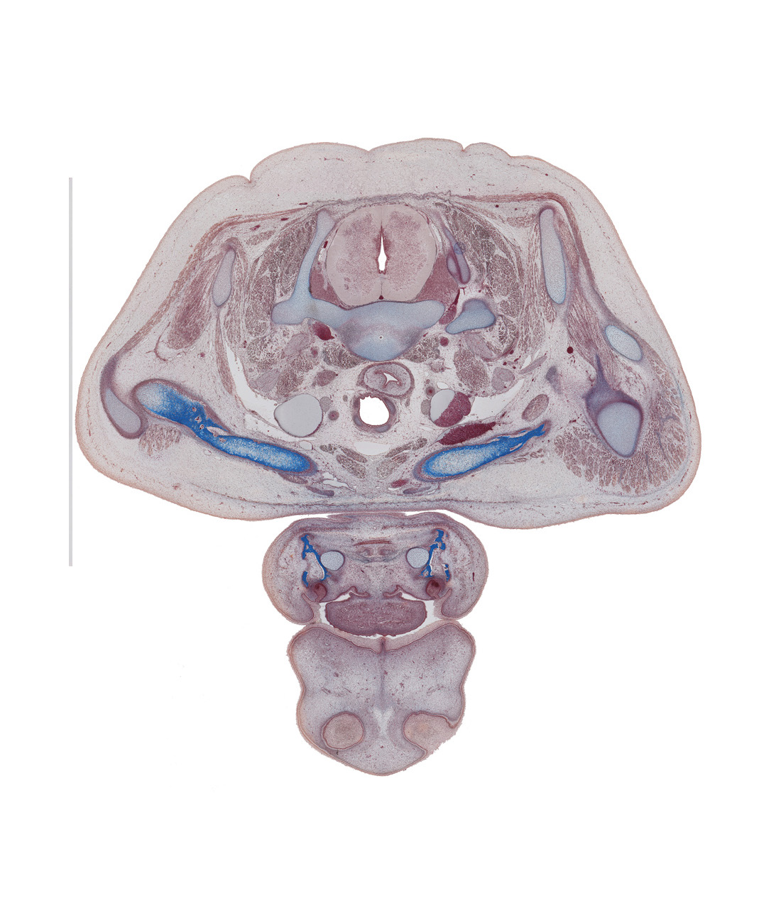 C-7 / T-1 intervertebral disc, C-8 spinal ganglion, acromioclavicular joint, body of clavicle, body of tongue, common carotid artery, deltoid muscle, dorsal horn of grey matter, epithelial plug in naris, internal jugular vein, scapula, serratus anterior muscle, serratus posterior superior muscle, spinalis muscle, sternohyoid muscle, tracheal cartilage, trapezius muscle, vagus nerve (CN X), ventral horn of grey matter