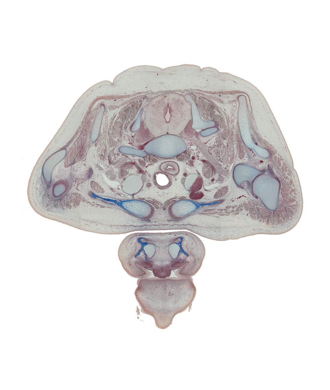 C-8 spinal ganglion, C-8 ventral root, acromion process of scapula, common carotid artery, costotransverse joint, edge of nose, esophagus, head of humerus, lower lip, lower trunk of brachial plexus (C-8, T-1), lymph sac, neural arch of T-1 vertebra, platysma muscle, scalene anterior muscle, scapula, subclavian artery, subscapularis muscle, suprasternal notch, tip of tongue, trachea, upper lip