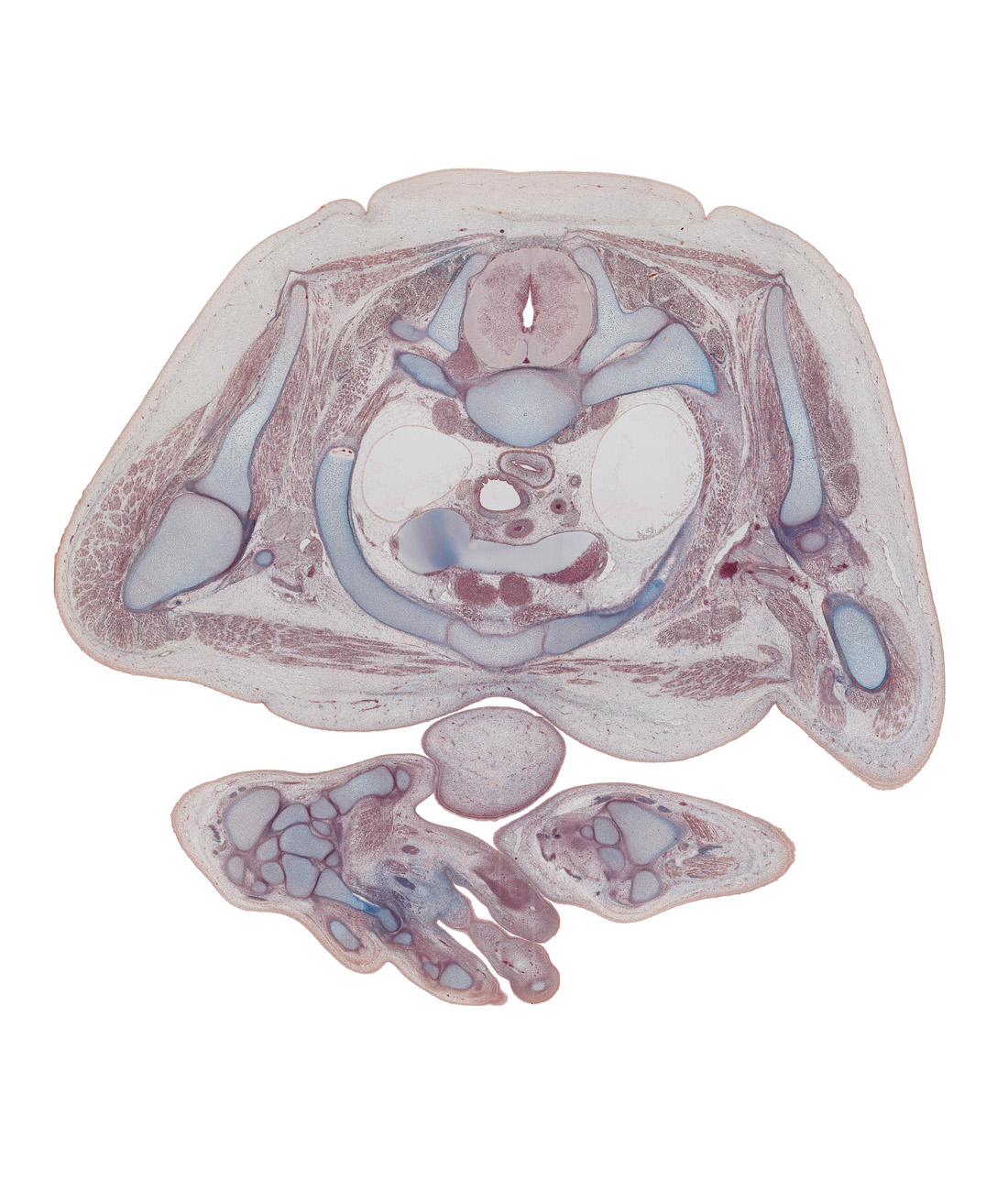 T-1 / T-2 interganglion region, axilla, central canal, chin, deltoid muscle, digit 1 (thumb), digit 2 (index finger), dorsal horn of grey matter, glenohumeral joint, hamate, humerus, infraspinatus muscle, junction of brachiocephalic veins, lateral horn of grey matter, left subclavian artery, metacarpal of digit 1 (thumb), neural arch of T-2 vertebra, pectoralis minor muscle, rib 1 (costal cartilage), rib 2, scaphoid, scapula, sternocostal joint of rib 1, subscapularis muscle, sympathetic trunk, trapezius muscle, ventral horn of grey matter