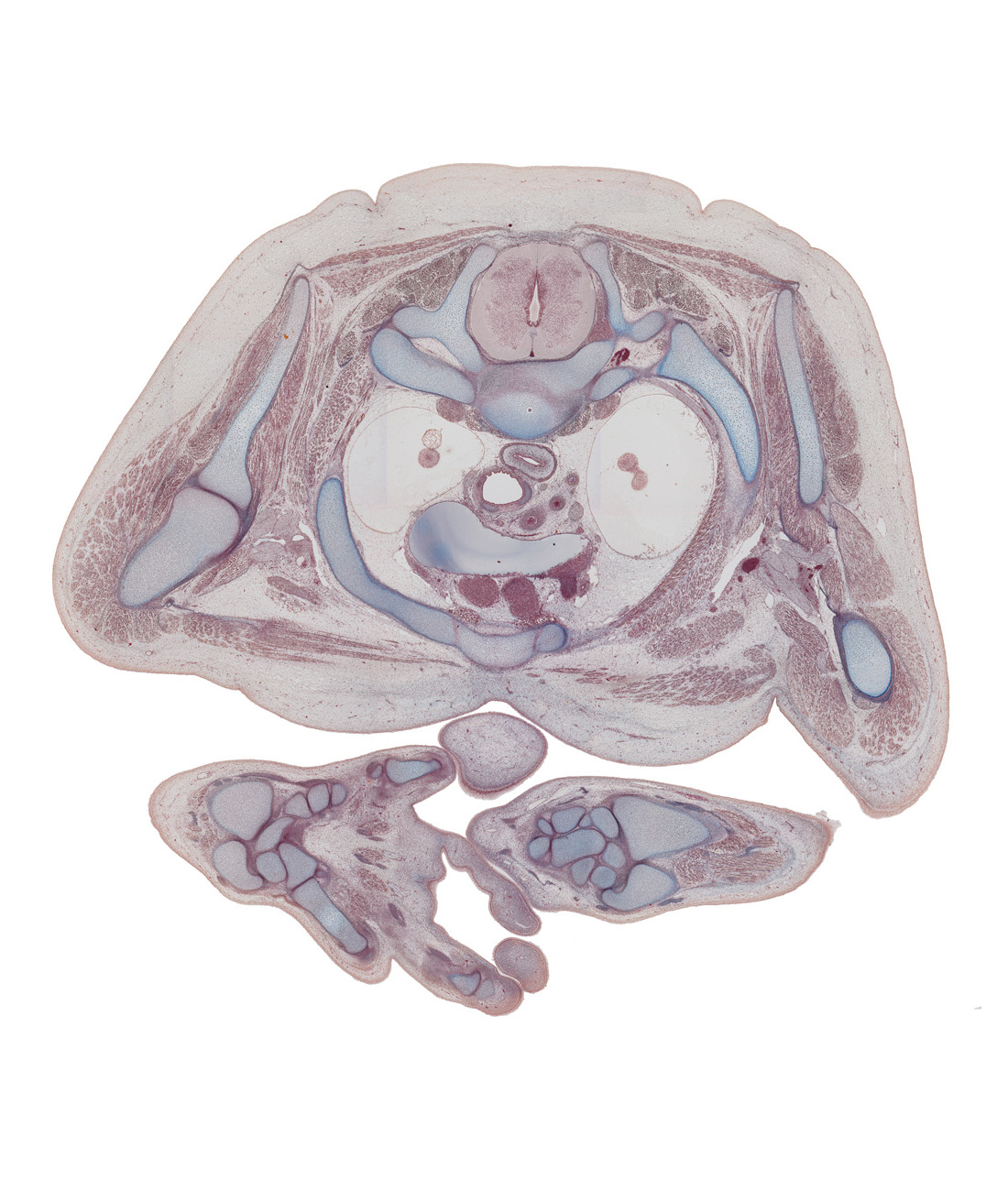 T-1 / T-2 intervertebral disc, T-2 spinal ganglion, apex of left lung, apex of right lung, brachiocephalic artery, carpometacarpal joint of digit 5 (little finger), costovertebral joint, deltoid muscle, flexor digitorum tendons, head of ulna, left brachiocephalic vein, left common carotid artery, left lobe of thymus gland, left subclavian artery, lunate, pleural cavity, radius, rib 2, styloid process of ulna, superior vena cava, teres minor muscle, triquetrum