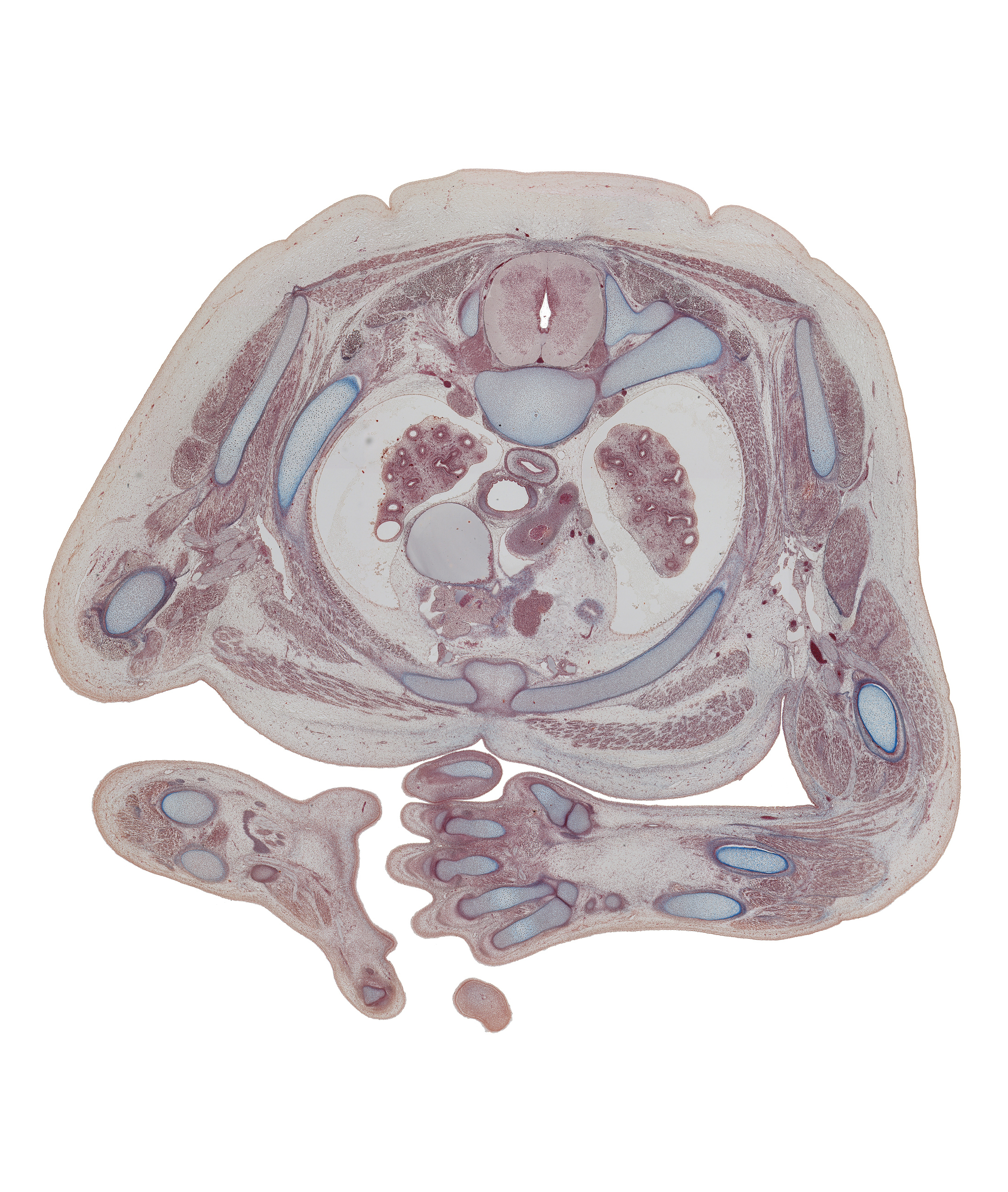 T-2 spinal ganglion, arch of aorta, central canal of spinal cord, costotransverse joint, dorsal funiculus, dorsal horn of grey matter, edge of pericardial cavity, edge of right atrium, esophagus, extensor muscle(s), humerus, interosseus muscle, left lobe of thymus gland, manubrosternal joint, metacarpal 5, neck of rib 3, radius, rib 2, scapula, trachea, ulna, upper lobe of left lung, upper lobe of right lung