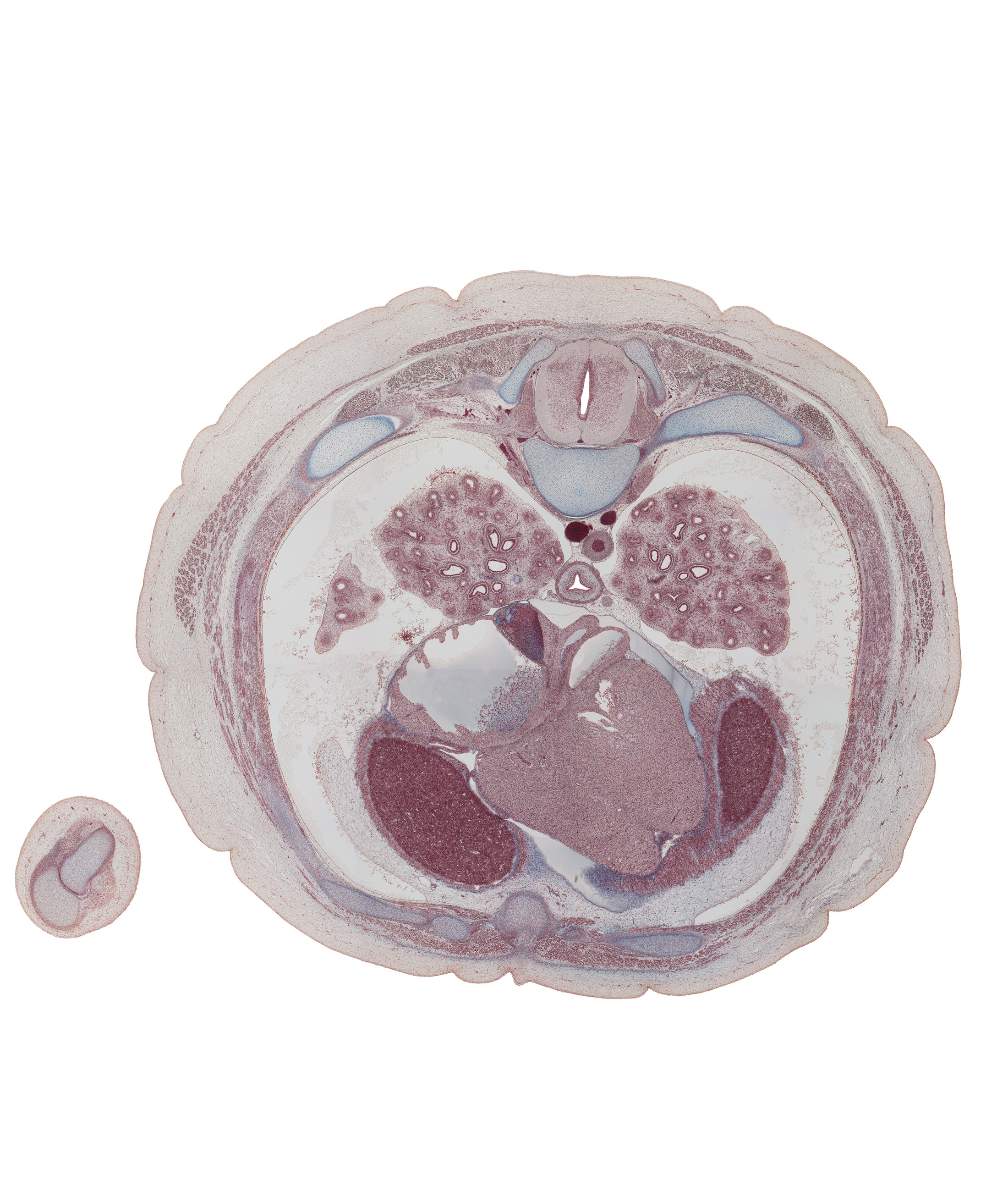 T-6 spinal ganglion, anterior rectus sheath, aorta, coronary sinus, esophagus, inferior vena cava, interventricular sulcus, latissimus dorsi muscle, left atrioventricular (mitral) valve, lower lobe of left lung, lower lobe of right lung, middle lobe of right lung, oblique fissure, pericardial cavity, posterior papillary muscle, rectus abdominis muscle, rib 6 (costal cartilage), rib 7, right atrium, serratus anterior muscle, sympathetic trunk, xiphoid