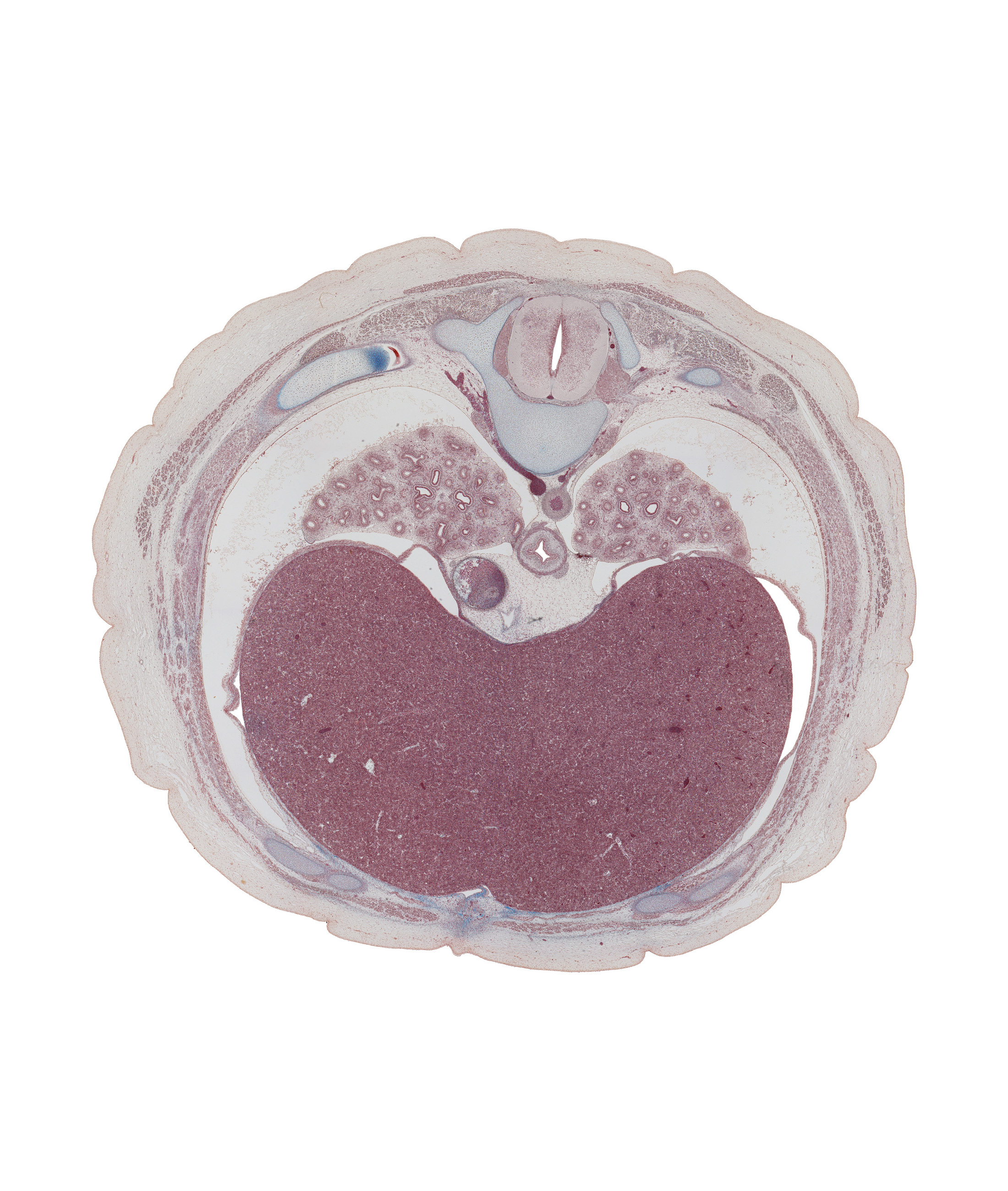 T-7 spinal ganglion, aorta, azygos vein, caudal part of pericardial cavity, central canal, central tendon of diaphragm, diaphragm, dorsal median septum, esophagus, inferior hemi-azygos vein, inferior vena cava, left lobe of liver, neural arch, posterior intercostal vein, right lobe of liver, spinal cord, transverse process, tubercle of rib 8