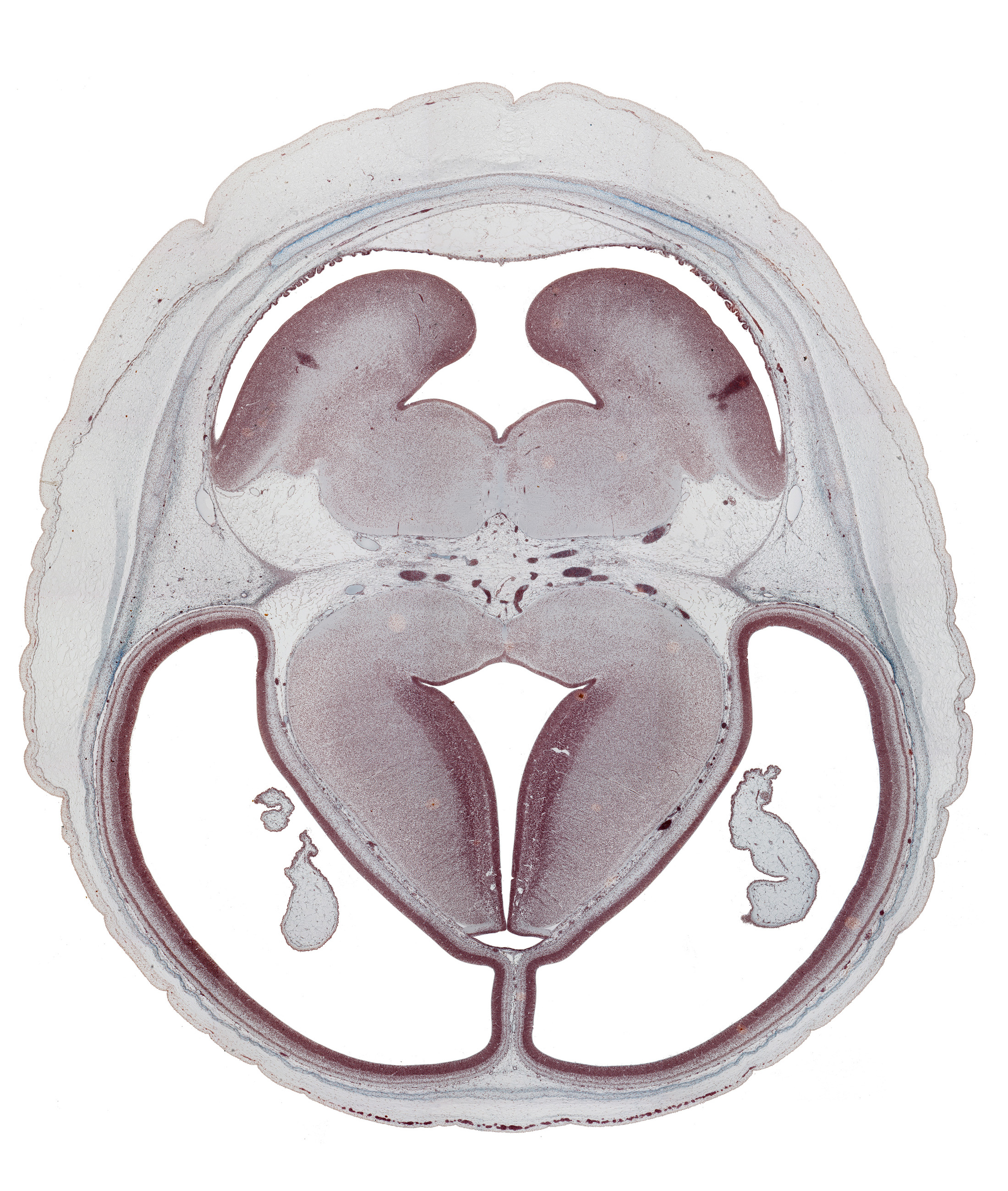 basis pedunculi of pons region (metencephalon), choroid plexus, dorsal thalamus, dural band for tentorium cerebelli, external germinal area, hypothalamic sulcus, intraventricular cerebellum, loose connective tissue space, mesencephalic artery, pons region (metencephalon), rhombencoel (fourth ventricle), subarachnoid space, subcutaneous vascular plexus, superior cerebellar artery, surface ectoderm, trochlear nerve (CN IV), ventral thalamus