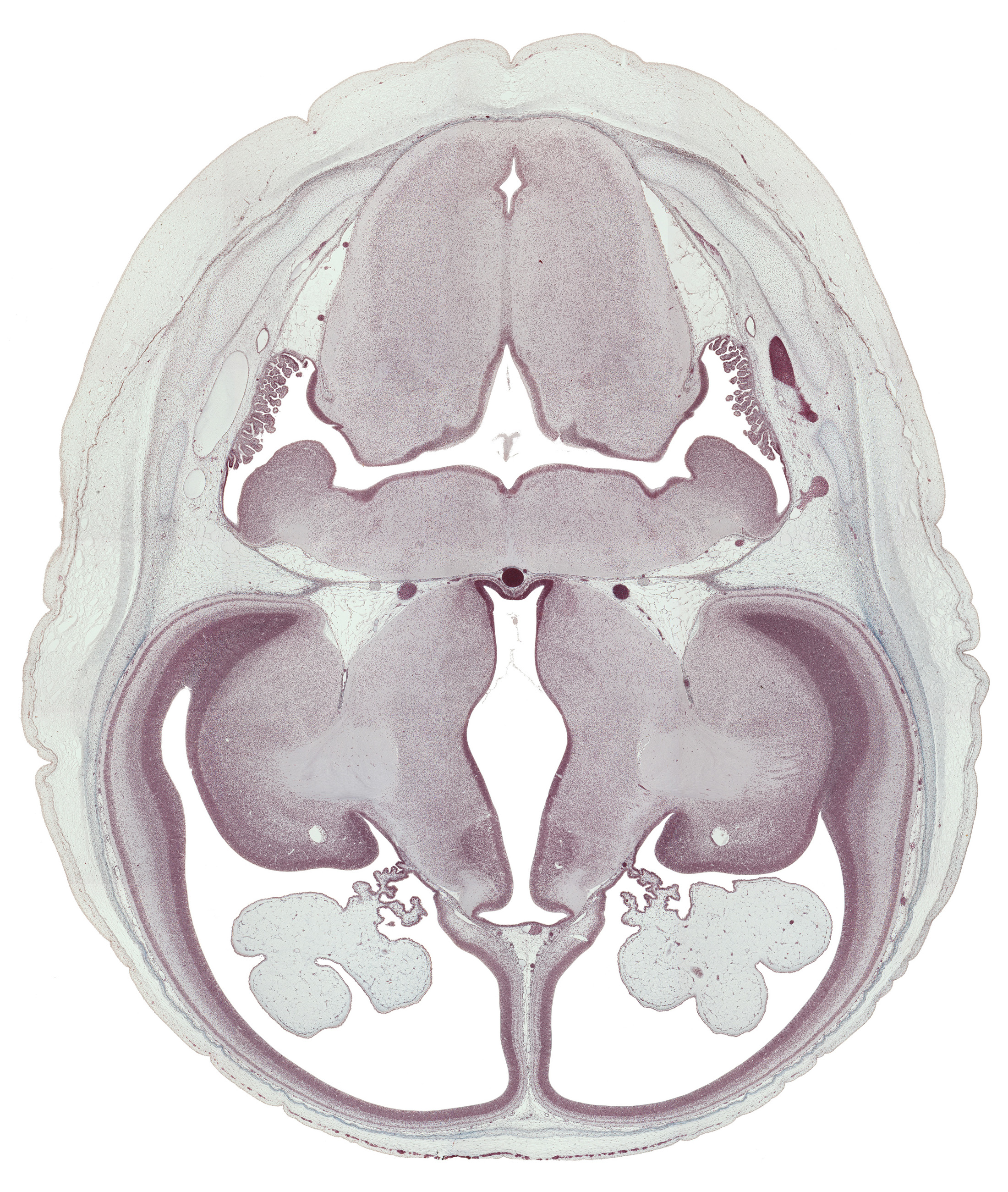 anterior inferior cerebellar artery, basilar artery, basis pedunculi of pons region (metencephalon), caudate nucleus, central canal, choroid fissure, choroid plexus, flocculus of cerebellum, hypothalamic sulcus, hypothalamus, insula of cerebral hemisphere, internal capsule, internal cerebellar swelling, medulla oblongata, posterior inferior cerebellar artery, rhombencoel (fourth ventricle), spinal tract of trigeminal nerve (CN V), temporal pole of cerebral hemisphere, third ventricle, transverse sinus, vascular plexus