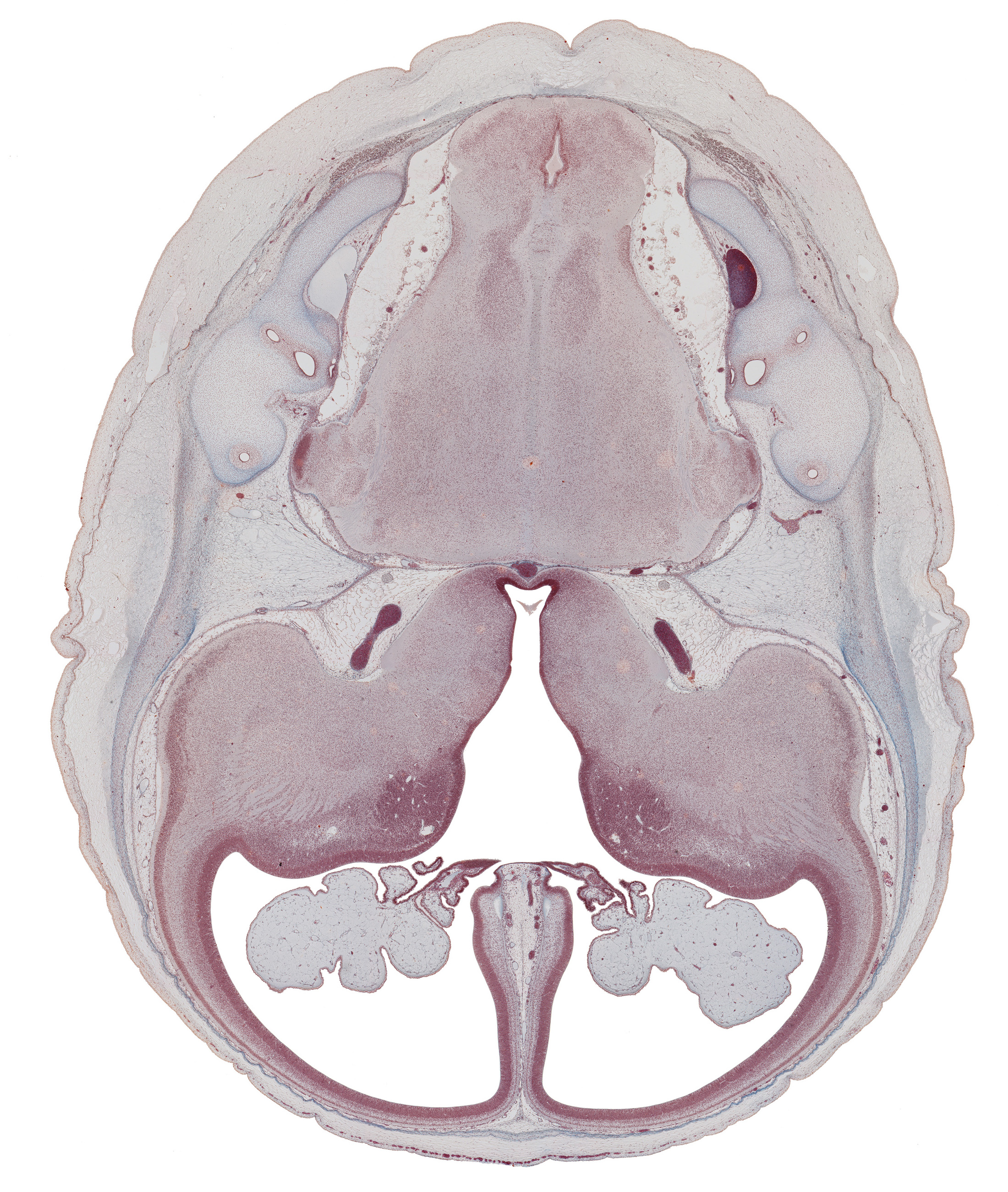 anterior semicircular duct, caudate nucleus, central canal, choroid plexus, common limb of semicircular duct, falx cerebri region, hippocampus, insula of cerebral hemisphere, internal carotid artery, interventricular foramen, lateral ventricle, medial accessory olivary nucleus, middle cerebral artery, posterior semicircular duct, pyramidal tract region, root of cranial accessory nerve (CN XI), root of glossopharyngeal nerve (CN IX), root of trigeminal nerve (CN V), root of vagus nerve (CN X), roots of vagus and cranial accessory nerves (CN X and CN XI), semispinalis capitis muscle, spinal tract of trigeminal nerve (CN V), third ventricle