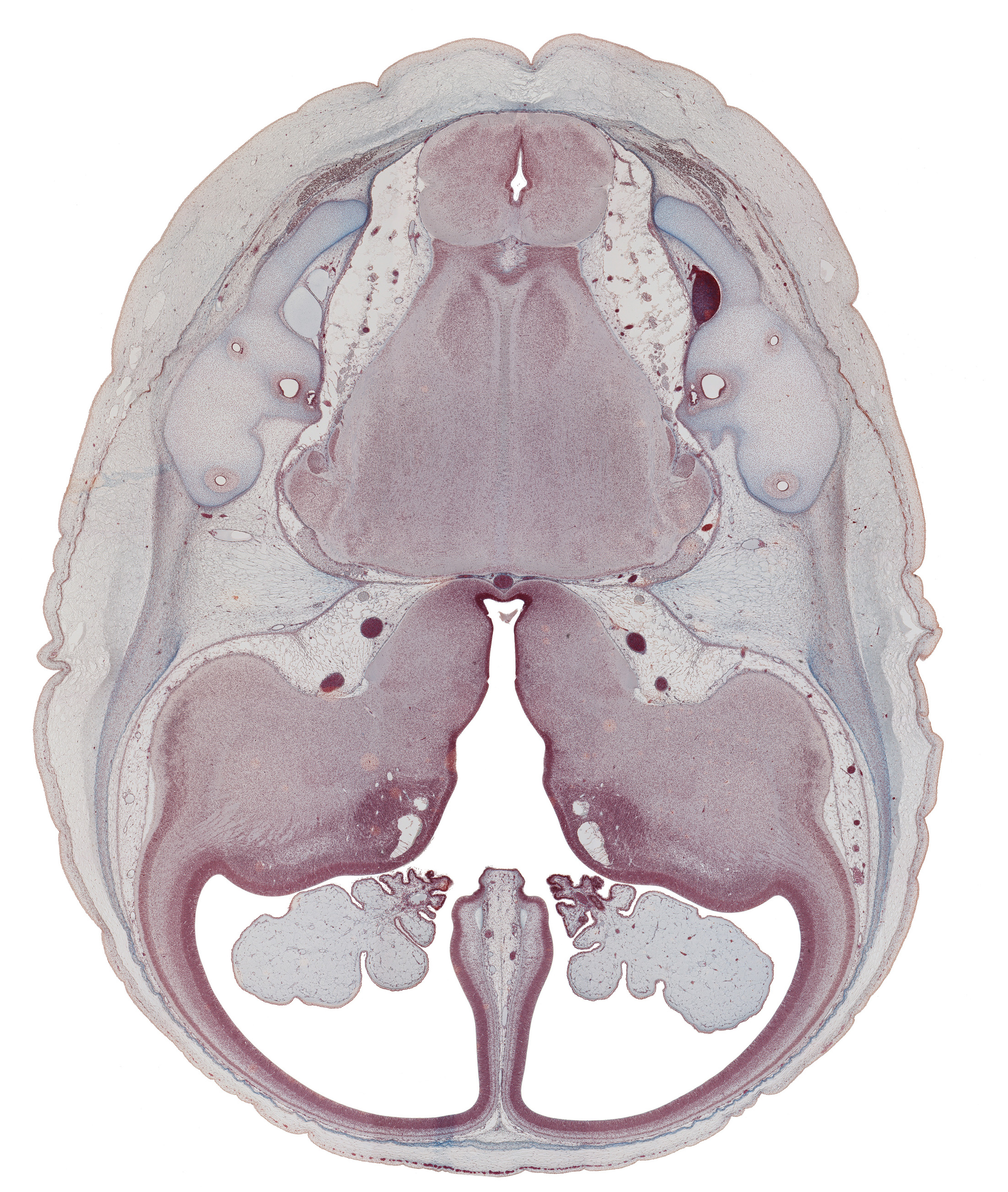 anterior inferior cerebellar artery, anterior semicircular duct, basilar artery, common limb of semicircular duct, cortical plate, decussation, endolymphatic duct, falx cerebri region, insula of cerebral hemisphere, internal carotid artery, lateral ventricle, lateral ventricular eminence (telencephalon), medial ventricular eminence (diencephalon), nucleus cuneatus, nucleus gracilis, nucleus of spinal tract of trigeminal nerve, oculomotor nerve (CN III), optic tract, pons region (metencephalon), posterior inferior cerebellar artery, posterior semicircular duct, pyramidal tract region, root of cranial accessory nerve (CN XI), root of glossopharyngeal nerve (CN IX), root of vagus nerve (CN X), subarachnoid space, third ventricle, trochlear nerve (CN IV)