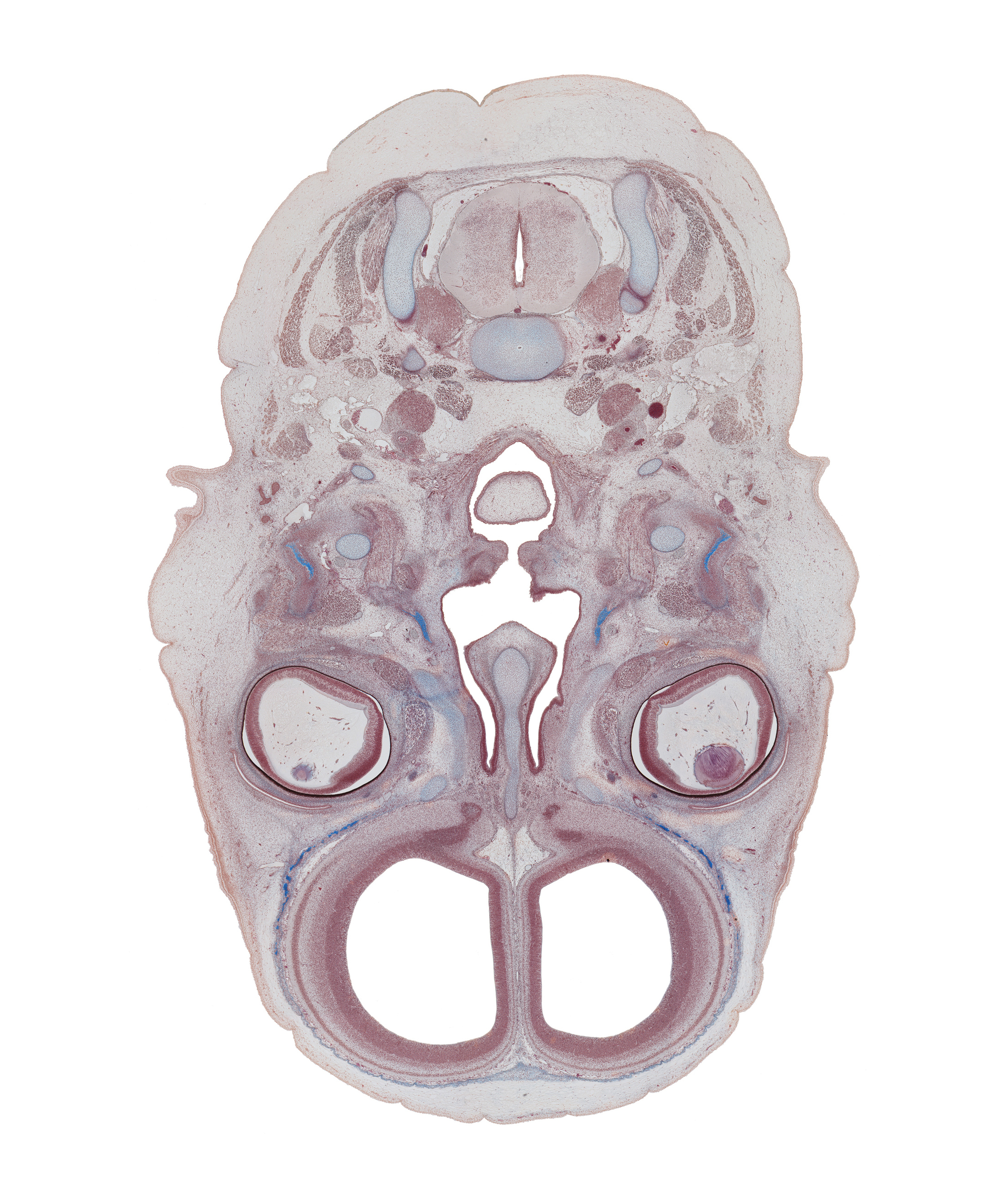 C-3 spinal ganglion, choana, cortical plate, falx cerebri region, frontal bone ossification, frontal lobe region of cerebral hemisphere, inferior ganglion of vagus nerve (CN X), intraretinal space (optic vesicle cavity), laryngeal pharynx, longissimus capitis muscle, medial pterygoid muscle, nasal cavity (nasal sac), nasal septal cartilage, nasopharynx, neural layer of retina, oropharynx, pigmented layer of retina, retropharyngeal space, semispinalis capitis muscle, splenius muscle, superior pharyngeal constrictor muscle, superior sagittal sinus, trapezius muscle, unfused palatine shelf