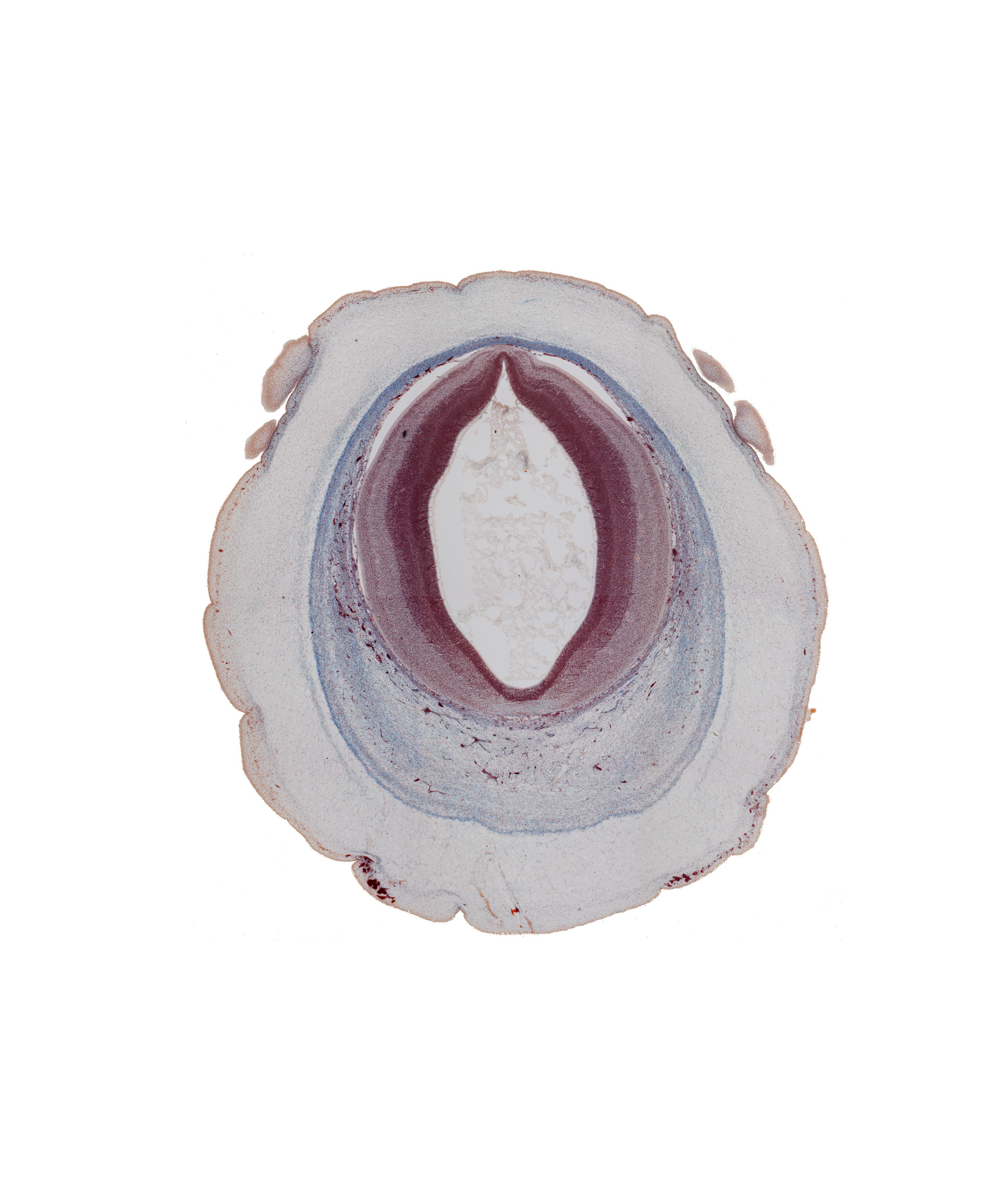 cerebral aqueduct (mesocoele), intermediate zone, loose connective tissue, marginal zone, osteogenic layer, pericranium, roof plate of mesencephalon, subarachnoid space, surface ectoderm, ventricular zone