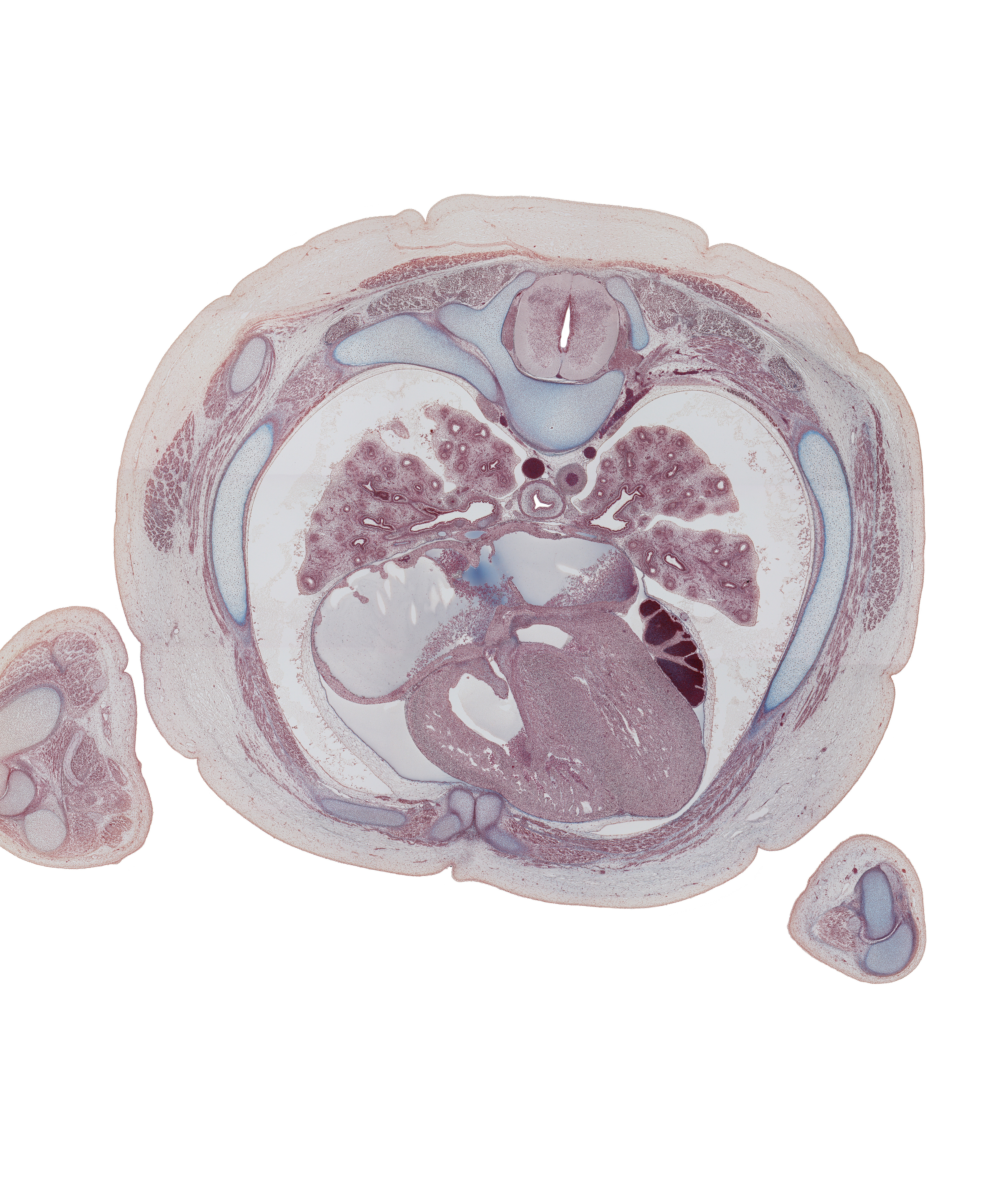 T-5 spinal ganglion, aortic vestibule, costotransverse joint, dorsal horn of grey matter, foramen ovale, hemisternum, lateral horn of grey matter, left phrenic nerve, lower lobe of left lung, lower lobe of right lung, medial segmental bronchus of middle lobe of right lung, membranous part of interventricular septum, middle lobe of right lung, muscular part of interventricular septum, oblique fissure, rib 4 (costal cartilage), rib 5, right ventricle, trapezius muscle, ulna, ulnar nerve, upper lobe of left lung, valve of foramen ovale, ventral horn of grey matter