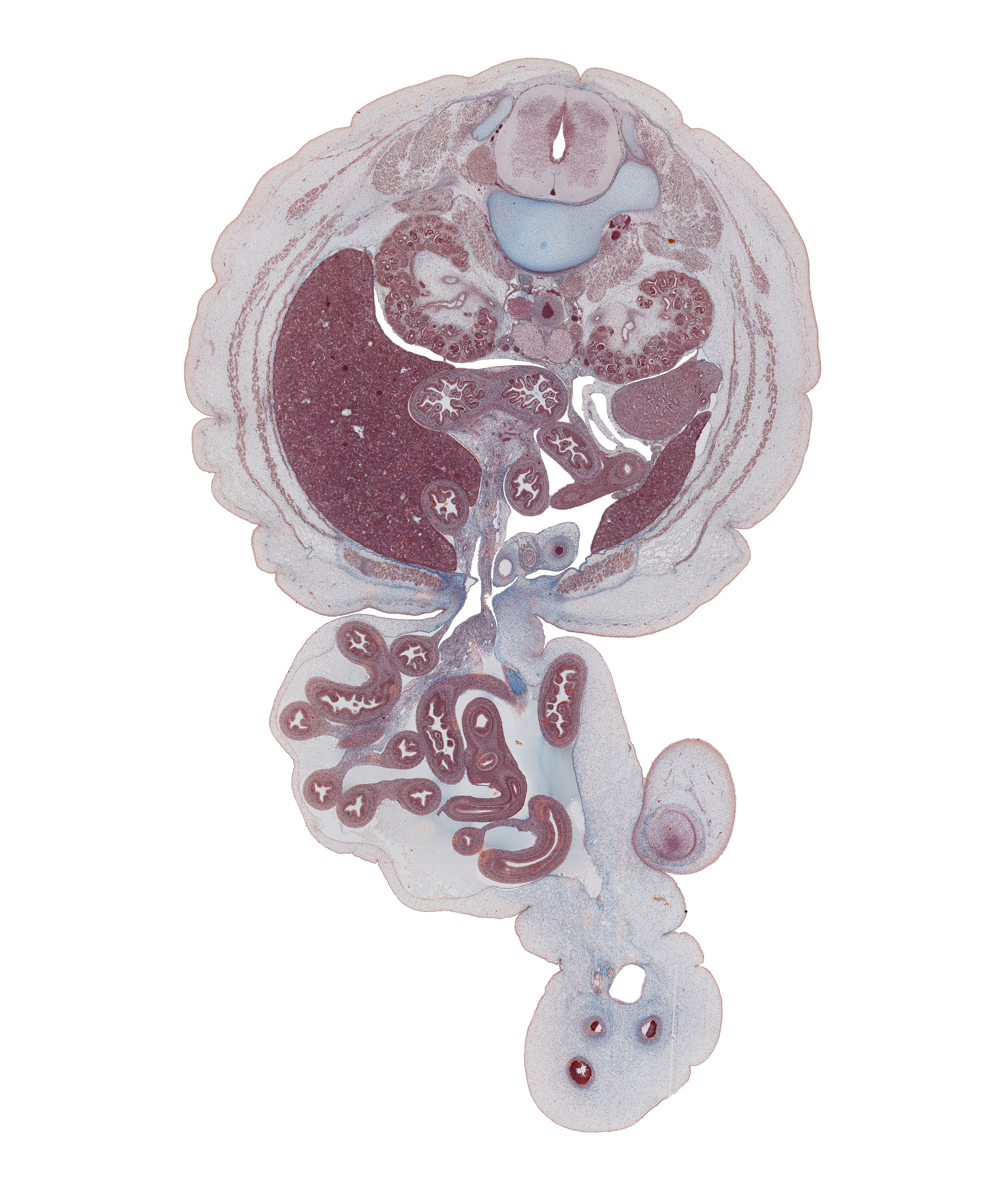 L-1 / L-2 interganglion region, allantoic vesicle(s), aorta, aorticorenal ganglion, appendix, ascending part of duodenum, cecum, colon, descending part of duodenum, herniated midgut, hilum of kidney (metanephros), inferior major calyx, inferior vena cava, jejunum, left lobe of liver, left umbilical artery, medial condyle of femur, minor calyx, right lobe of liver, right umbilical artery, testis, umbilical cord, umbilical vein, umbilical vesicle stalk, urachus, ureter