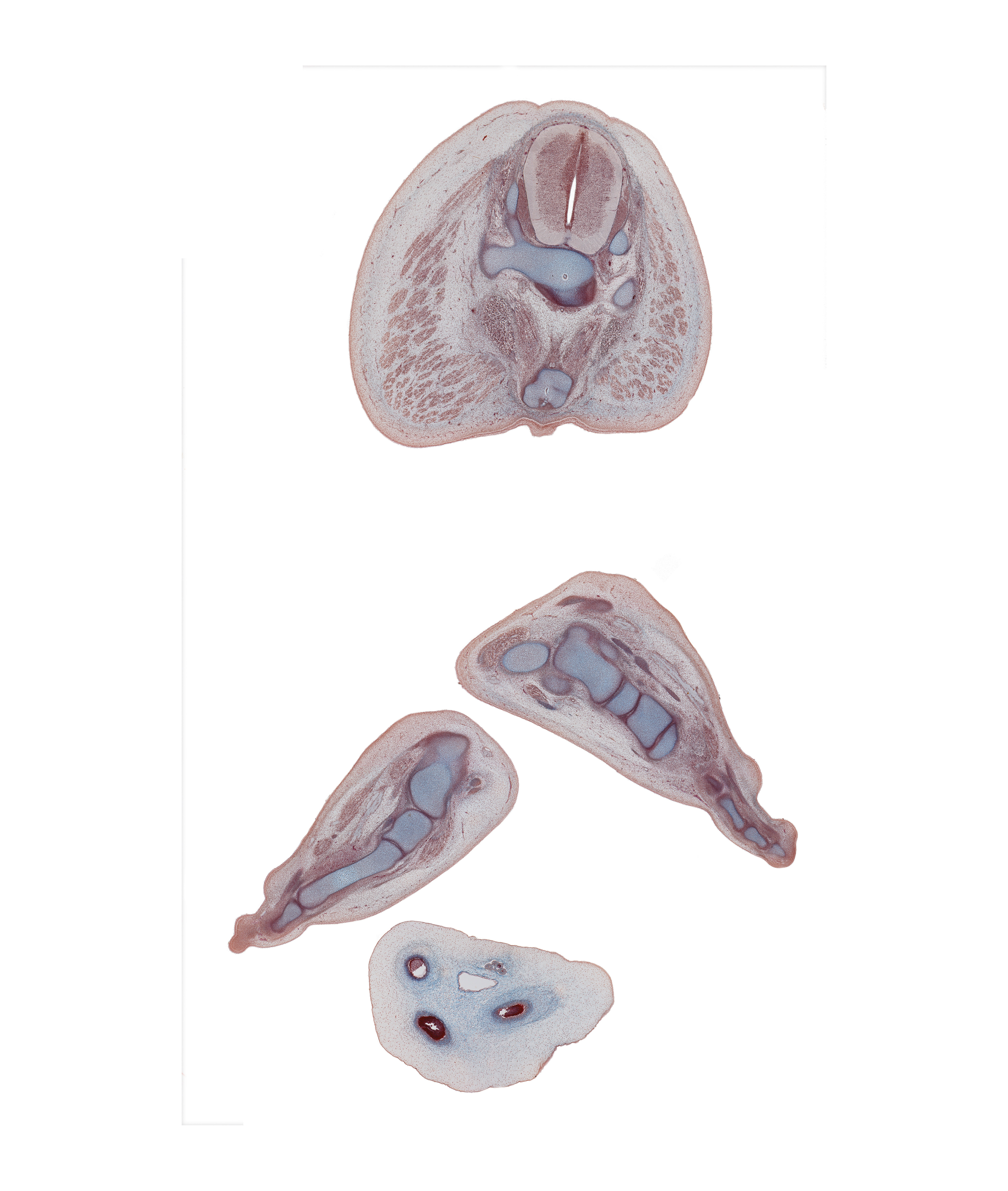 S-4 spinal ganglion, calcaneum, coccyx, cuboid, digit 4 (foot), fibularis longus and fibularis brevis tendons, gluteus maximus muscle, left foot, metatarsal 4, metatarsophalangeal joint of digit 4 (foot), right foot, sacrum, sympathetic trunk
