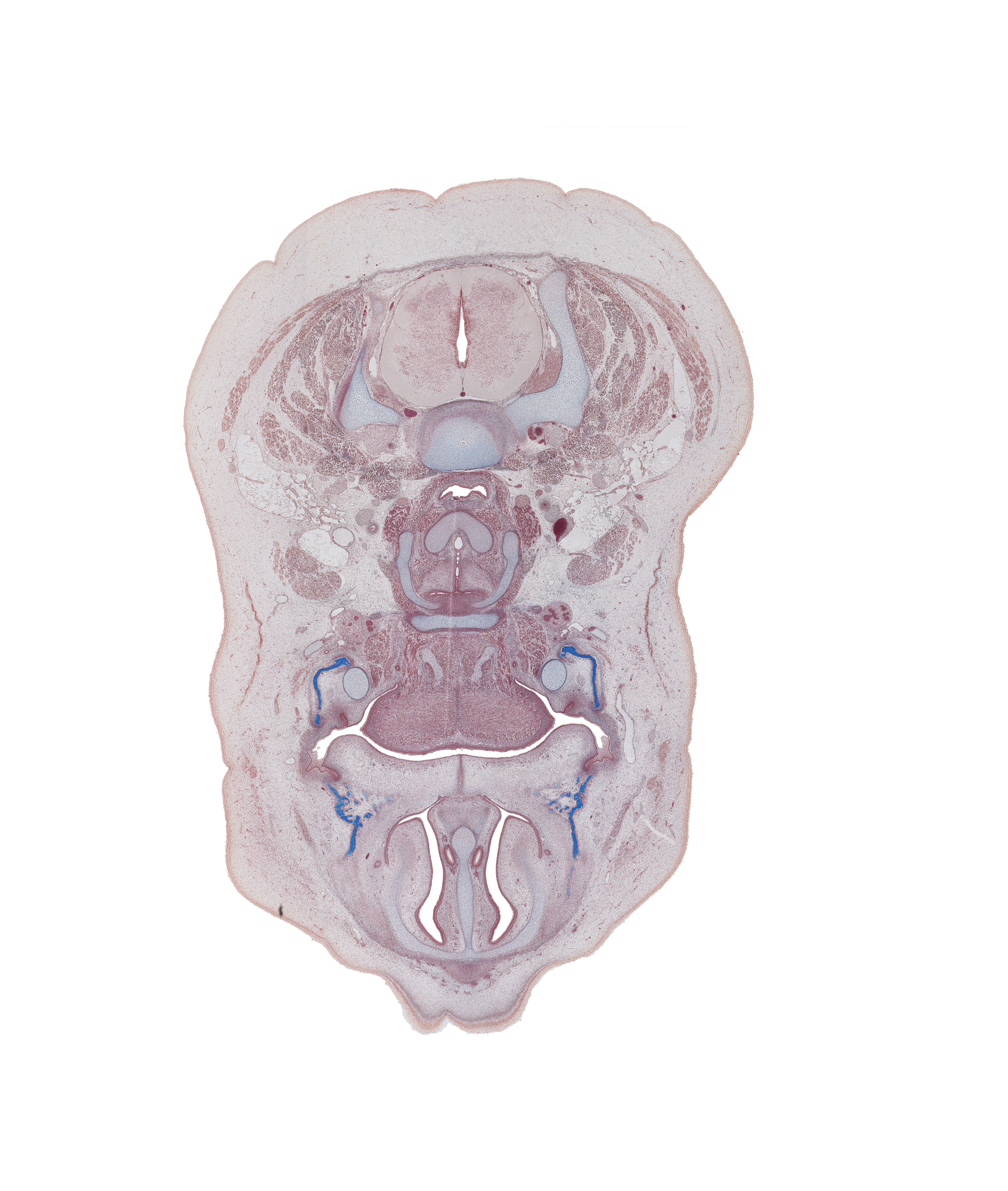 C-5 / C-6 intervertebral disc, C-6 spinal ganglion, body of hyoid (pharyngeal arch 3 cartilage), central canal, cricoid cartilage, hypoglossal nerve (CN XII), inferior nasal concha, laryngeal pharynx, mandible ossification, maxilla ossification, middle cervical sympathetic ganglion, nasal septum, palatine shelf, superior parathyroid gland, thyroid cartilage, vertebral artery in transverse foramen, vomeronasal duct