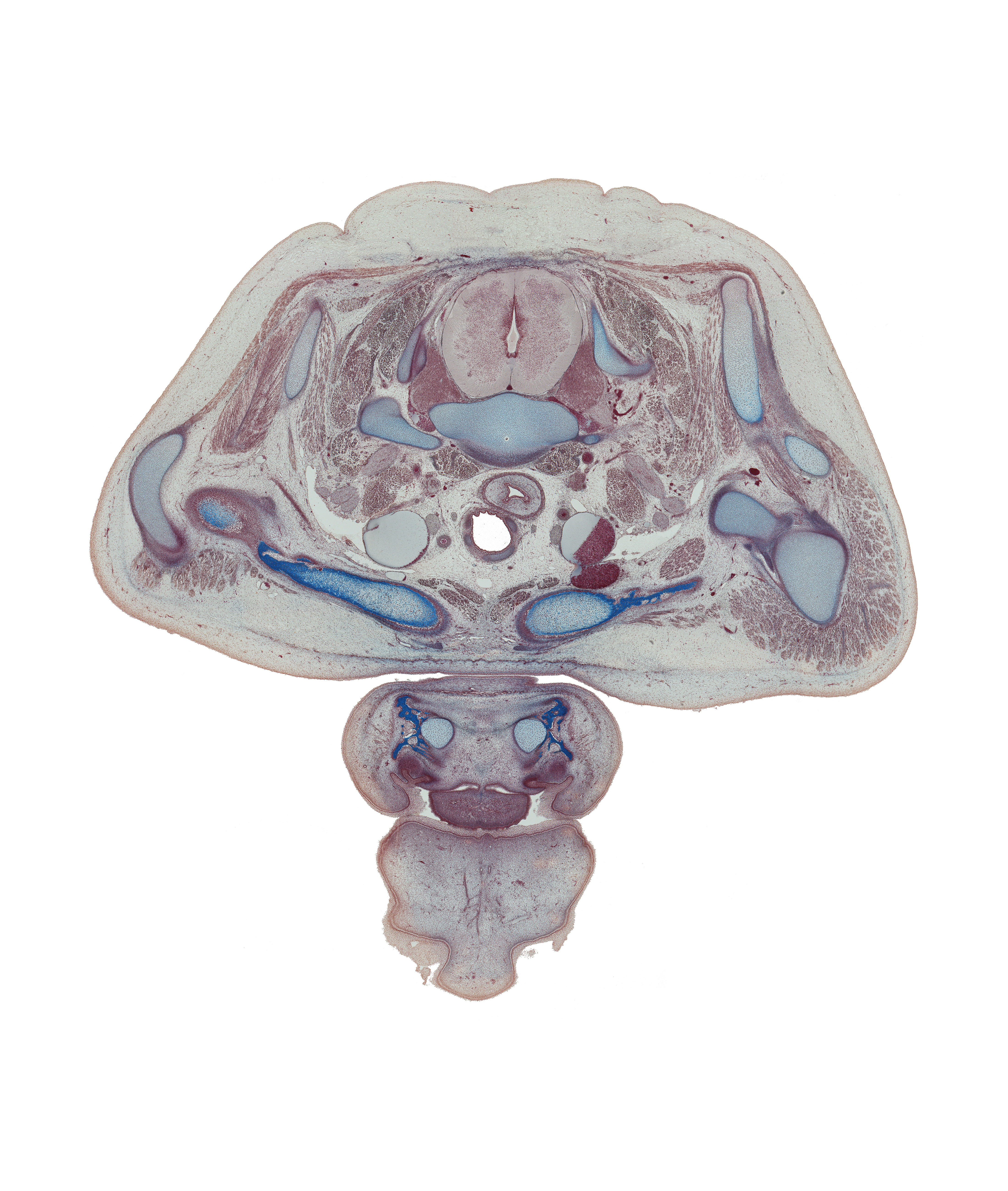C-8 spinal ganglion, central canal, clavicle, deltoid muscle, dorsal median septum, lower cervical sympathetic ganglion, lower trunk of brachial plexus (C-8, T-1), platysma muscle, retro-esophageal space, rhomboid minor muscle, right recurrent laryngeal nerve, scalene anterior muscle, scalenius medius muscle, superior belly of omohyoid muscle, supraspinatus muscle, trapezius muscle, upper lip, vagus nerve (CN X), ventral median septum