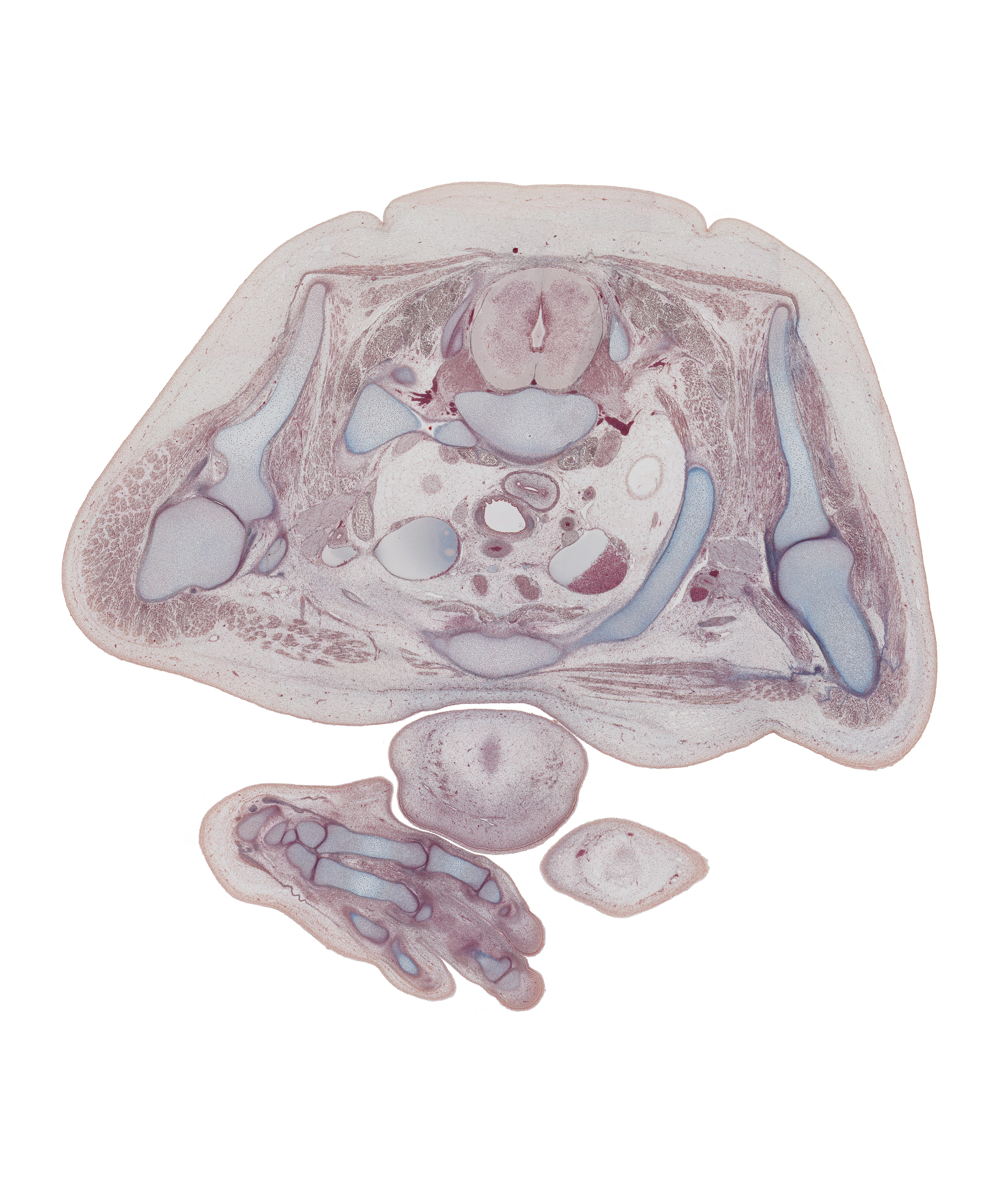 T-1 spinal ganglion, T-1 spinal nerve, axillary artery, axillary lymph sac, coracoid process of scapula, distal interphalangeal joint of digit 3 (middle finger), edge of left pleural cavity, edge of right pleural cavity, esophagus, extensor tendons, glenohumeral joint, interosseus muscle, left brachiocephalic vein, left lobe of thymus gland, manubrium of sternum, proximal interphalangeal joint of digit 2, rhomboid minor muscle, rib 1, right brachiocephalic vein, trapezius muscle, trapezoid, white matter