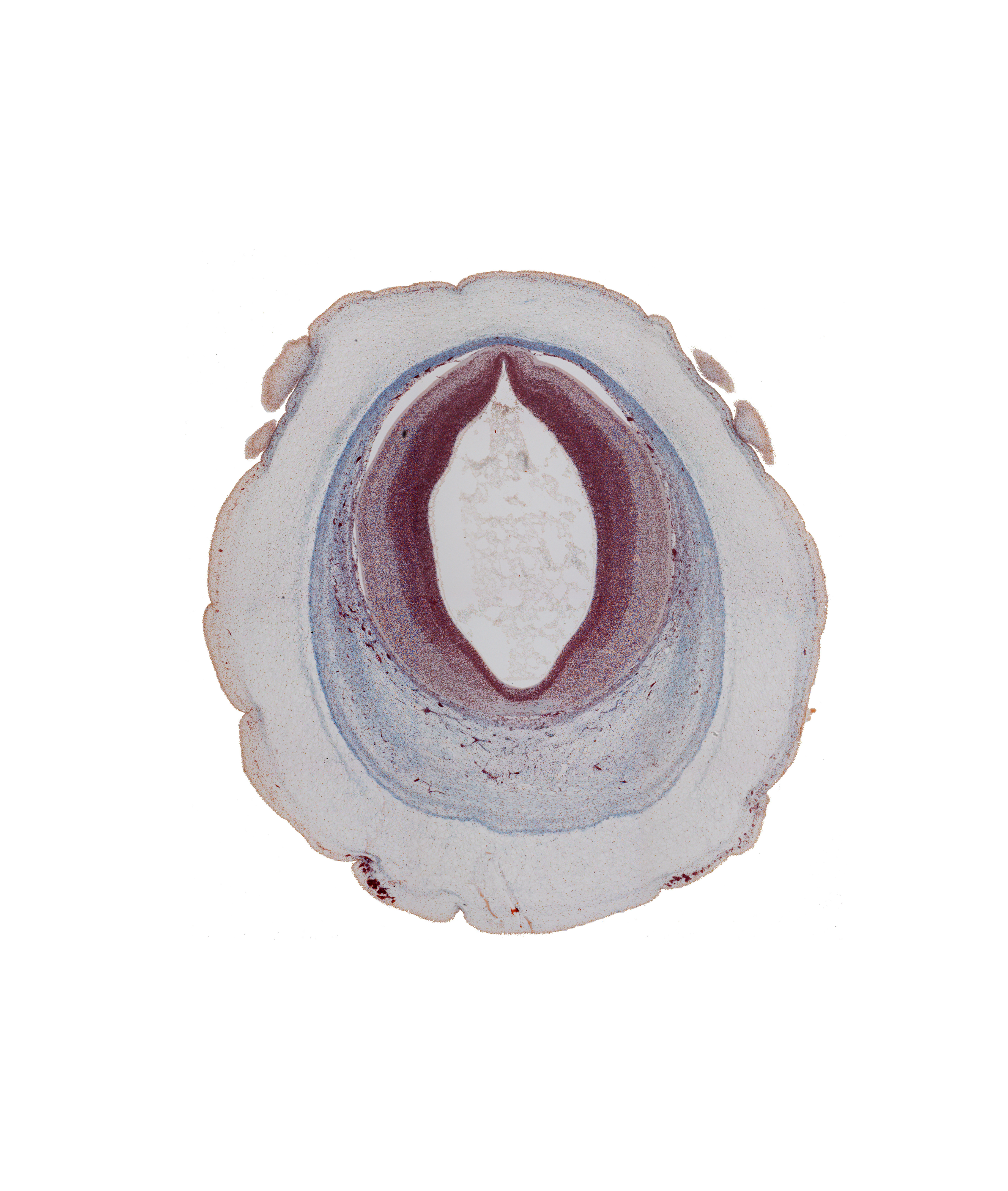 cerebral aqueduct (mesocoele), intermediate zone, loose connective tissue, marginal zone, osteogenic layer, pericranium, roof plate of mesencephalon, subarachnoid space, surface ectoderm, ventricular zone