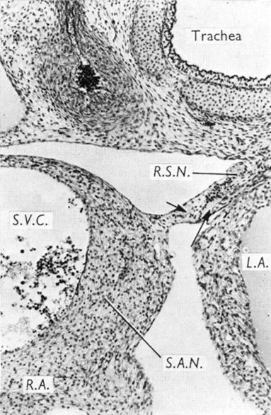 The sinu-atrial node and wall of right atrium of heart