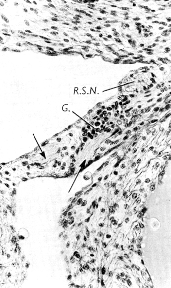 The venous mesocardium