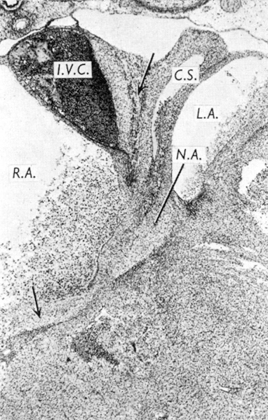 The caudal portion of the atrioventricular node