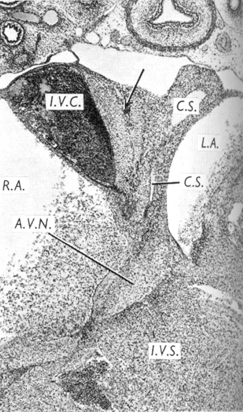 The atrioventricular node and interventricular septum