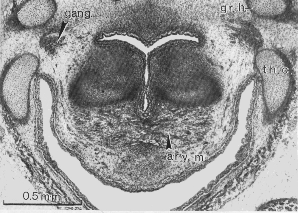 The greater horn of the hyoid (pharyngeal arch 3 cartilage) and the thyroid lamina