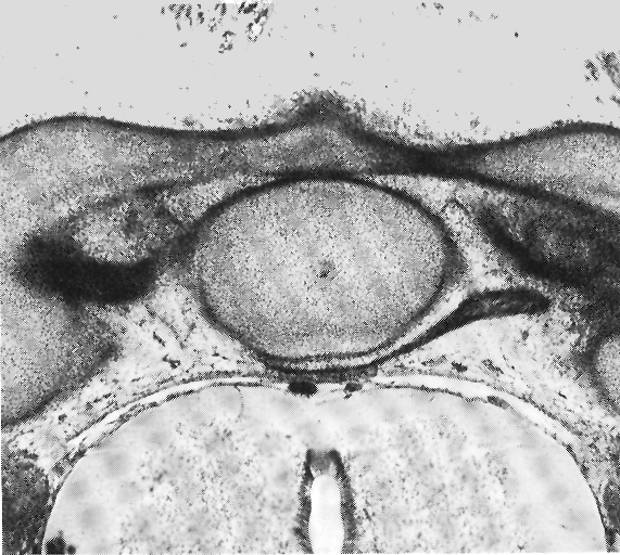 Transverse ligament of C-1 vertebra (atlas)