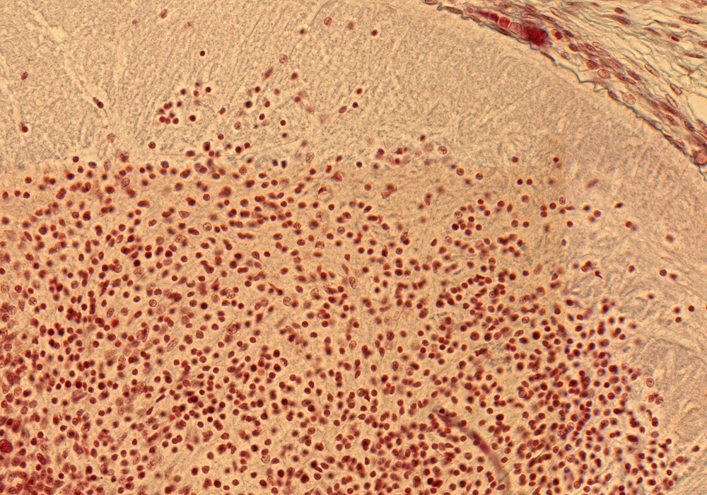 Dorsal Horn in Thoracic Region