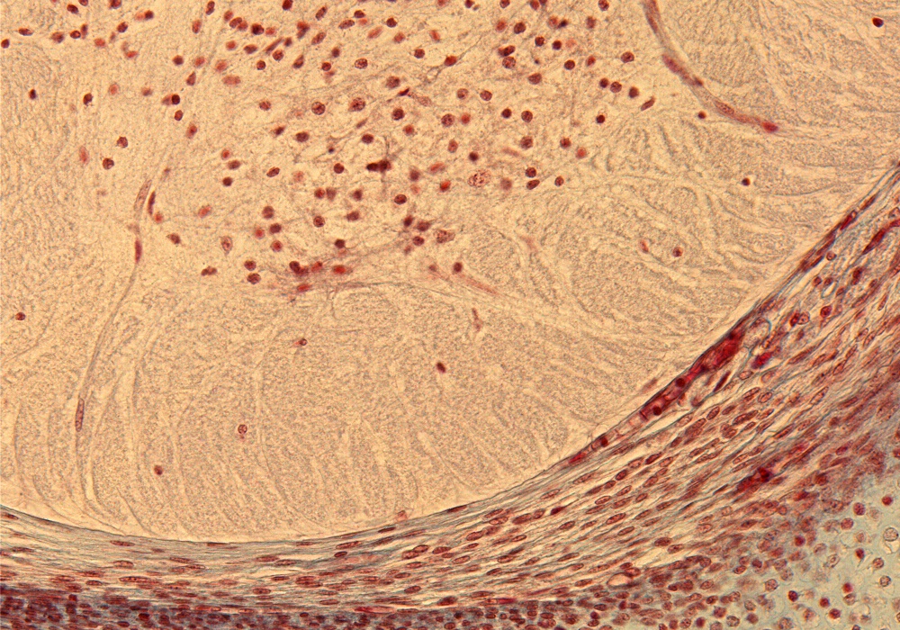 Ventral Horn in Thoracic Region