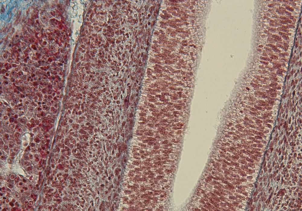 Colon Wall