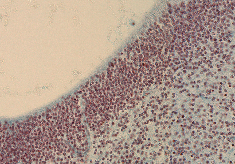 Tegmentum of Mesencephalon - Floor of Cerebral Aqueduct