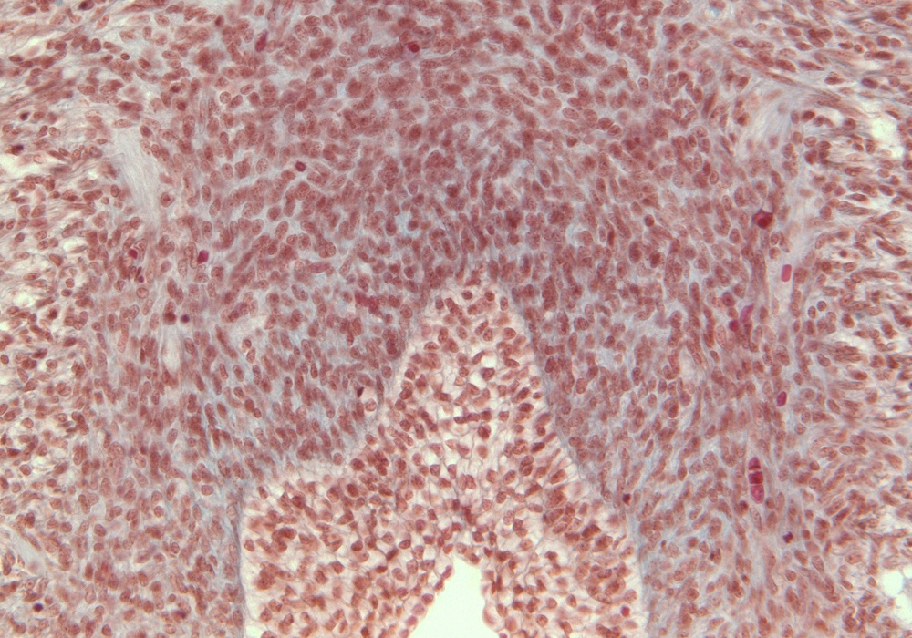 Anorectal Junction and Anal Canal